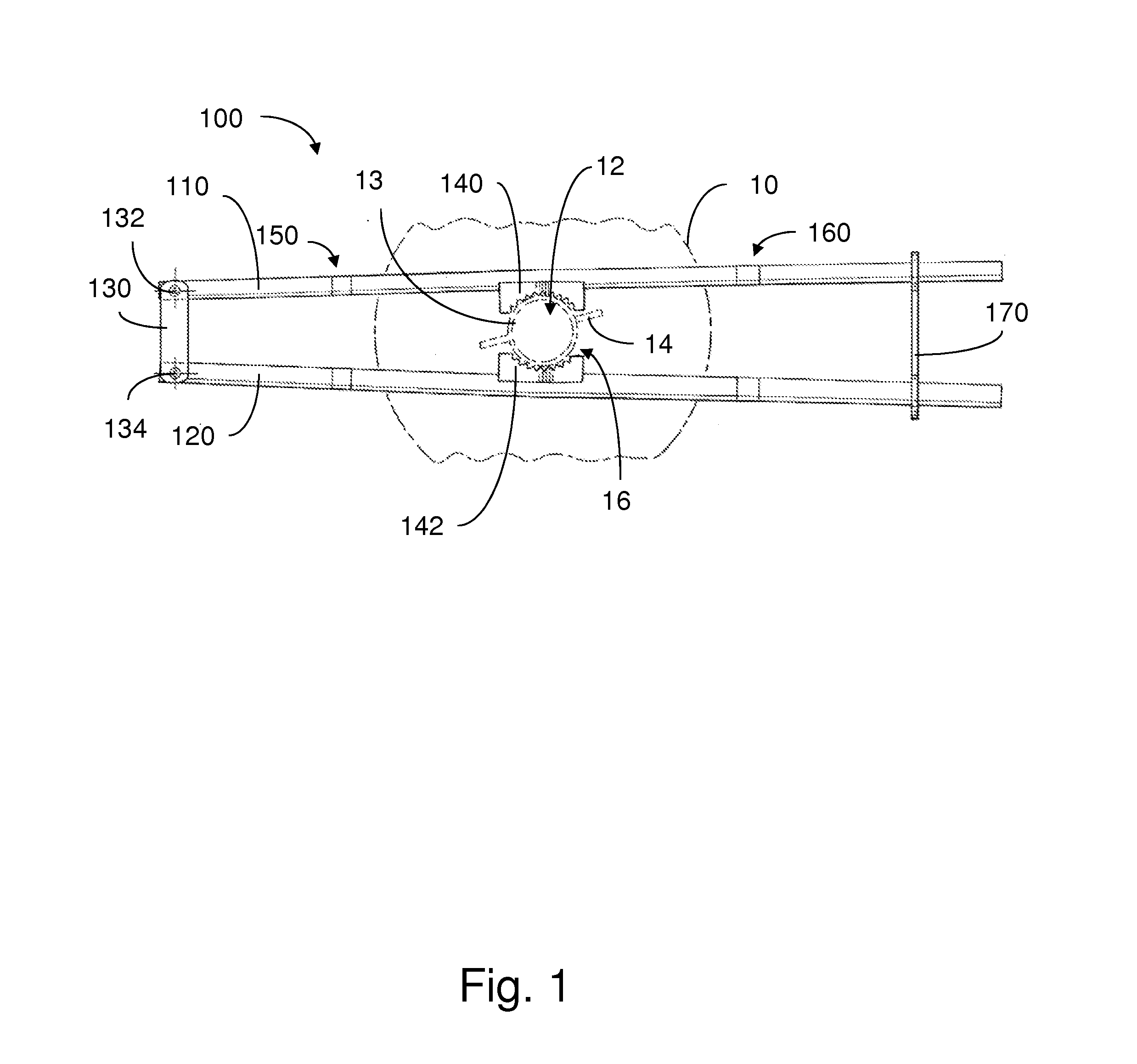 Method and apparatus for manipulating components of a filtration system