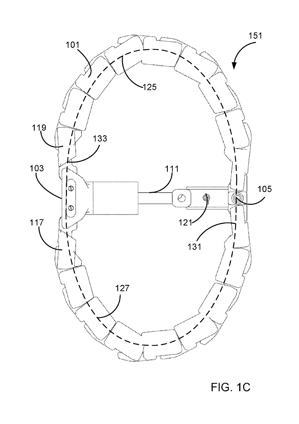 Implantable anchoring device and methods of use