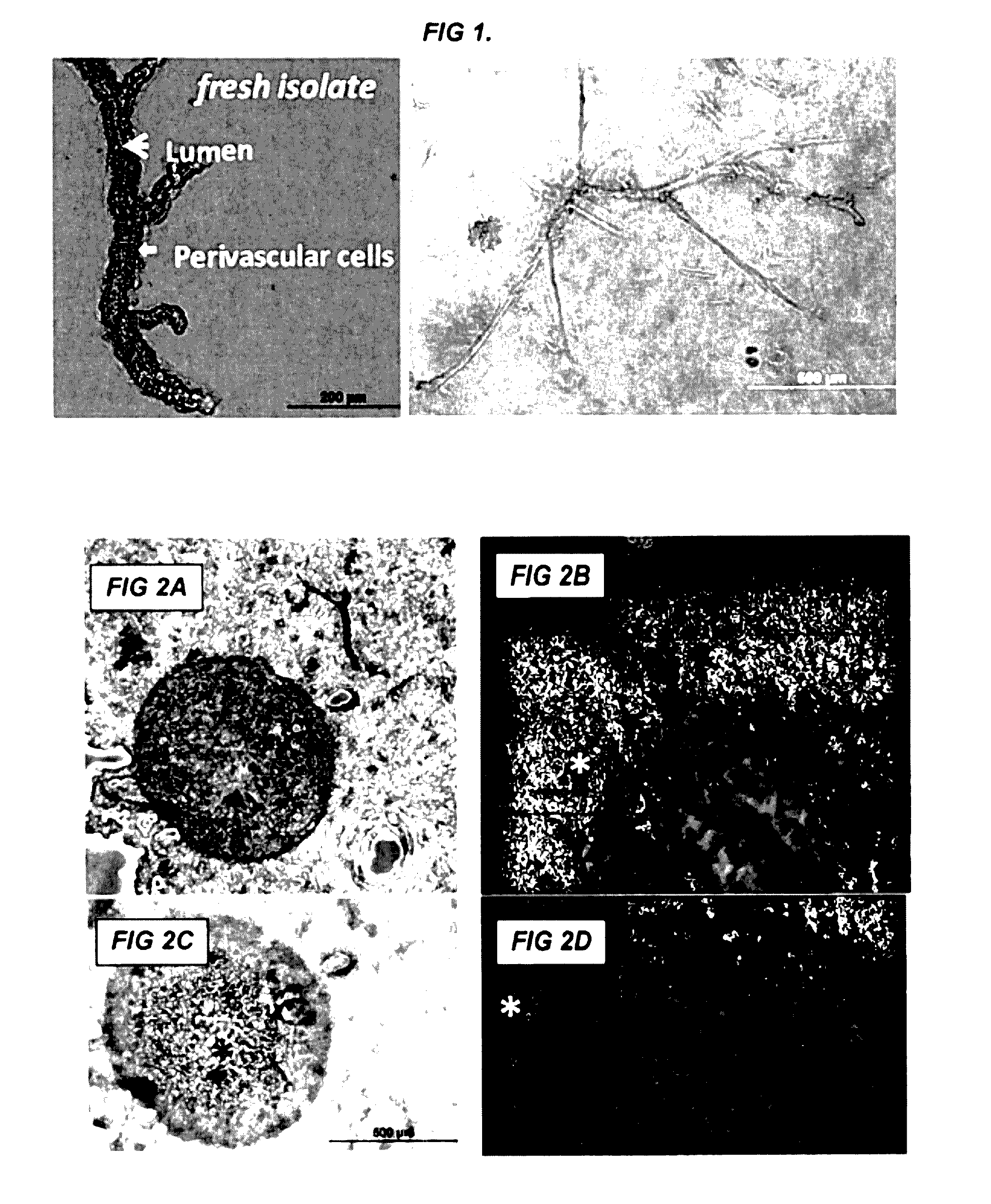 Methods and compositions to support transplanted tissue integration and innosculation with adipose stromal cells