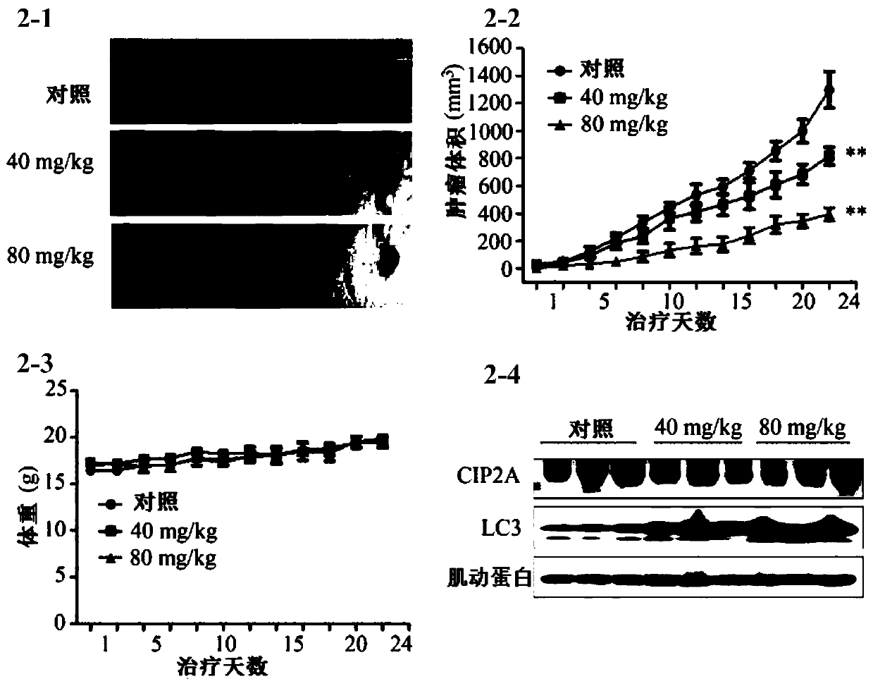 The application of ellagic acid and its synergy with triptolide in the preparation of anti-lung cancer drugs