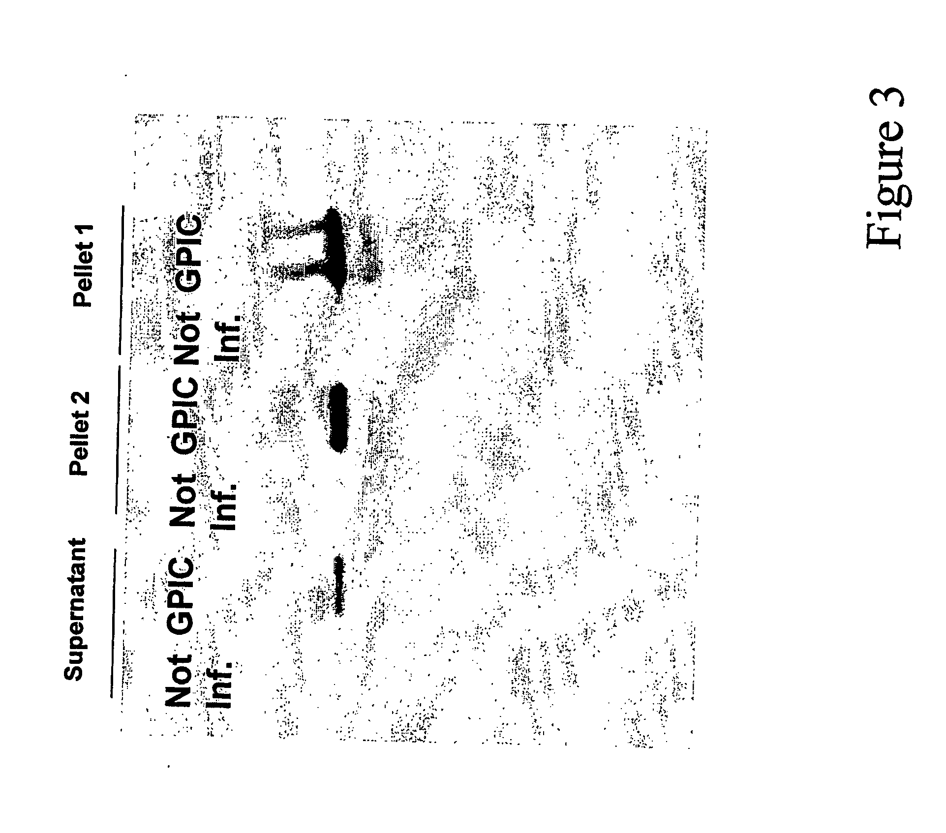 Secreted chlamydia polypeptides, polynucleotides coding therefor, therapeutic and diagnostic uses thereof