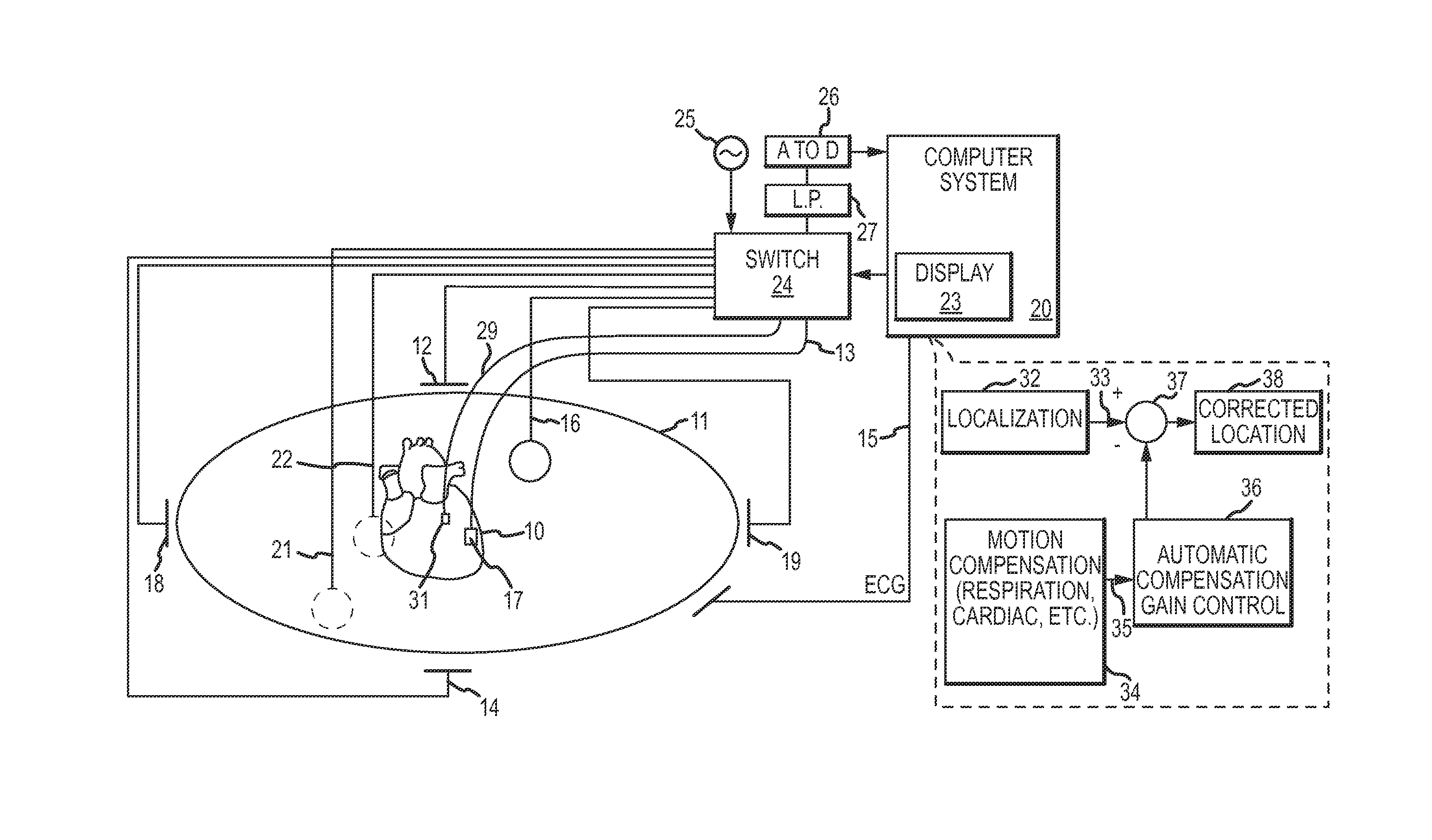 Dynamic adaptive respiration compensation with automatic gain control