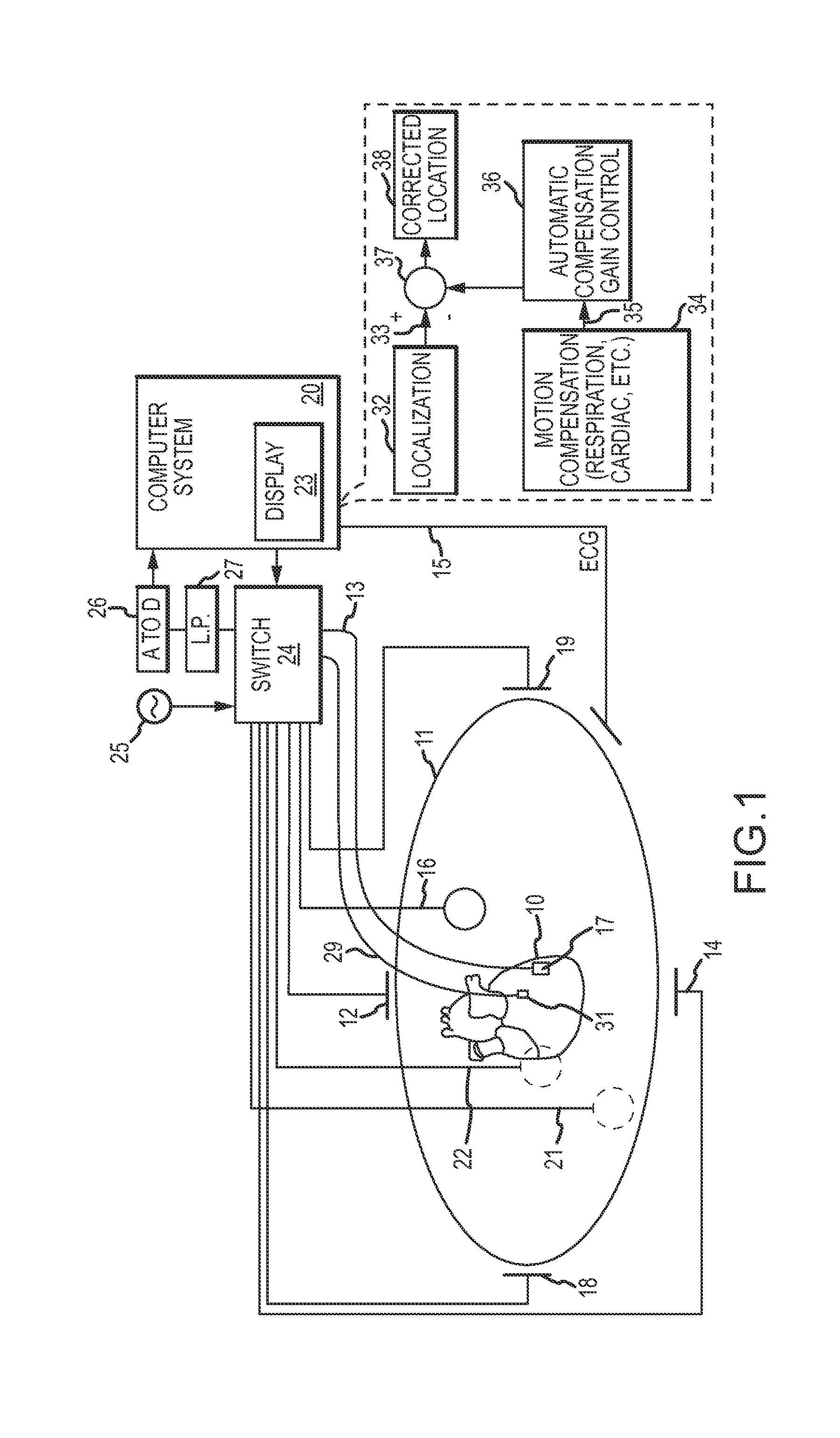 Dynamic adaptive respiration compensation with automatic gain control