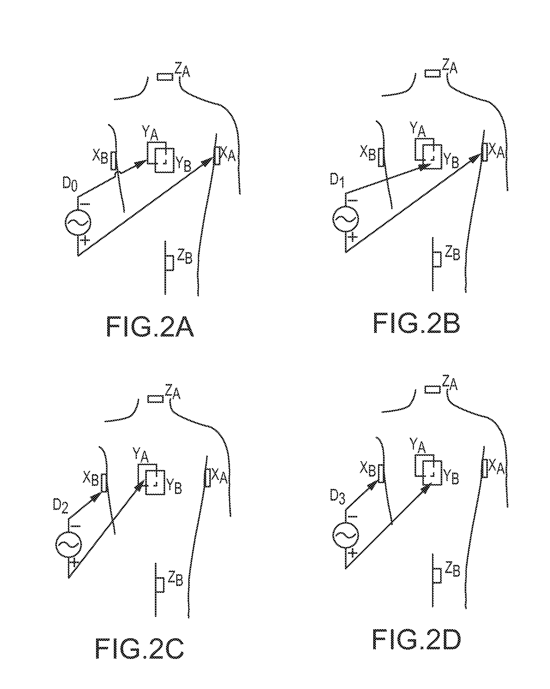 Dynamic adaptive respiration compensation with automatic gain control