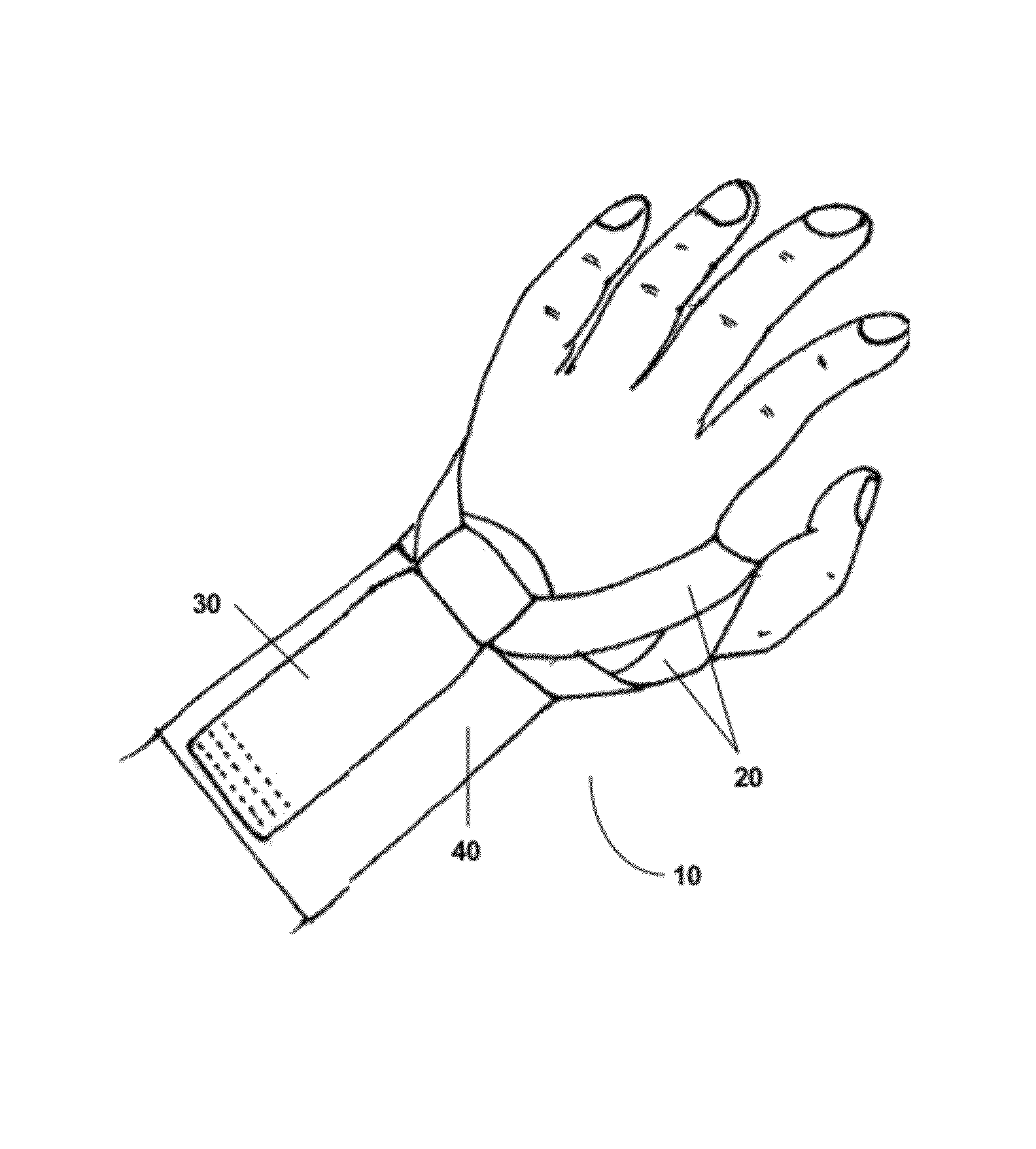 Modular upper extremity support system