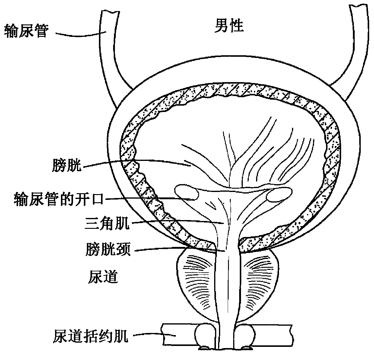 Urological stent
