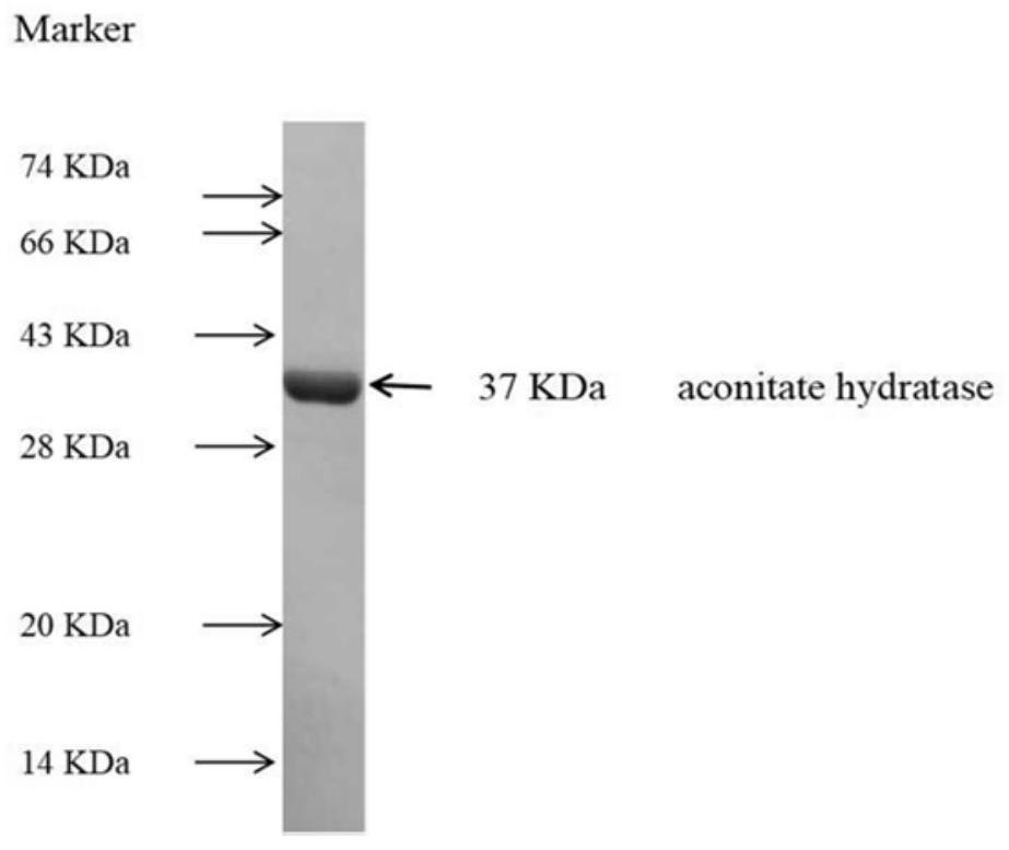 A detection kit for detecting anti-aconitic acid hydratase-igg antibody