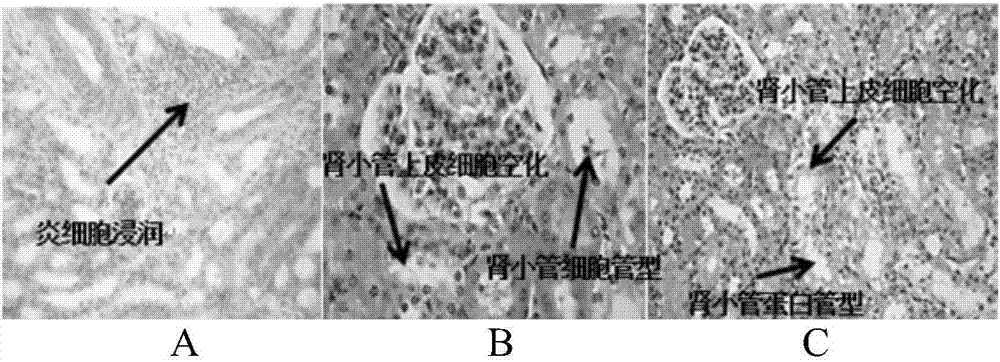 Application of sunflower small molecule peptide in reduction of uric acid, dissolving of uratoma and repairing of renal function