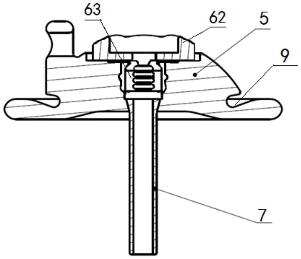 Heart valve replacement prosthesis and locking and fastening cardiac apex pad thereof