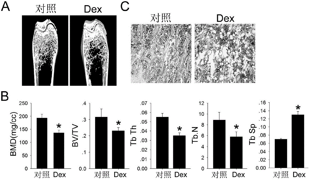 Prevention and treatment of bone disease caused by glucocorticoid drugs