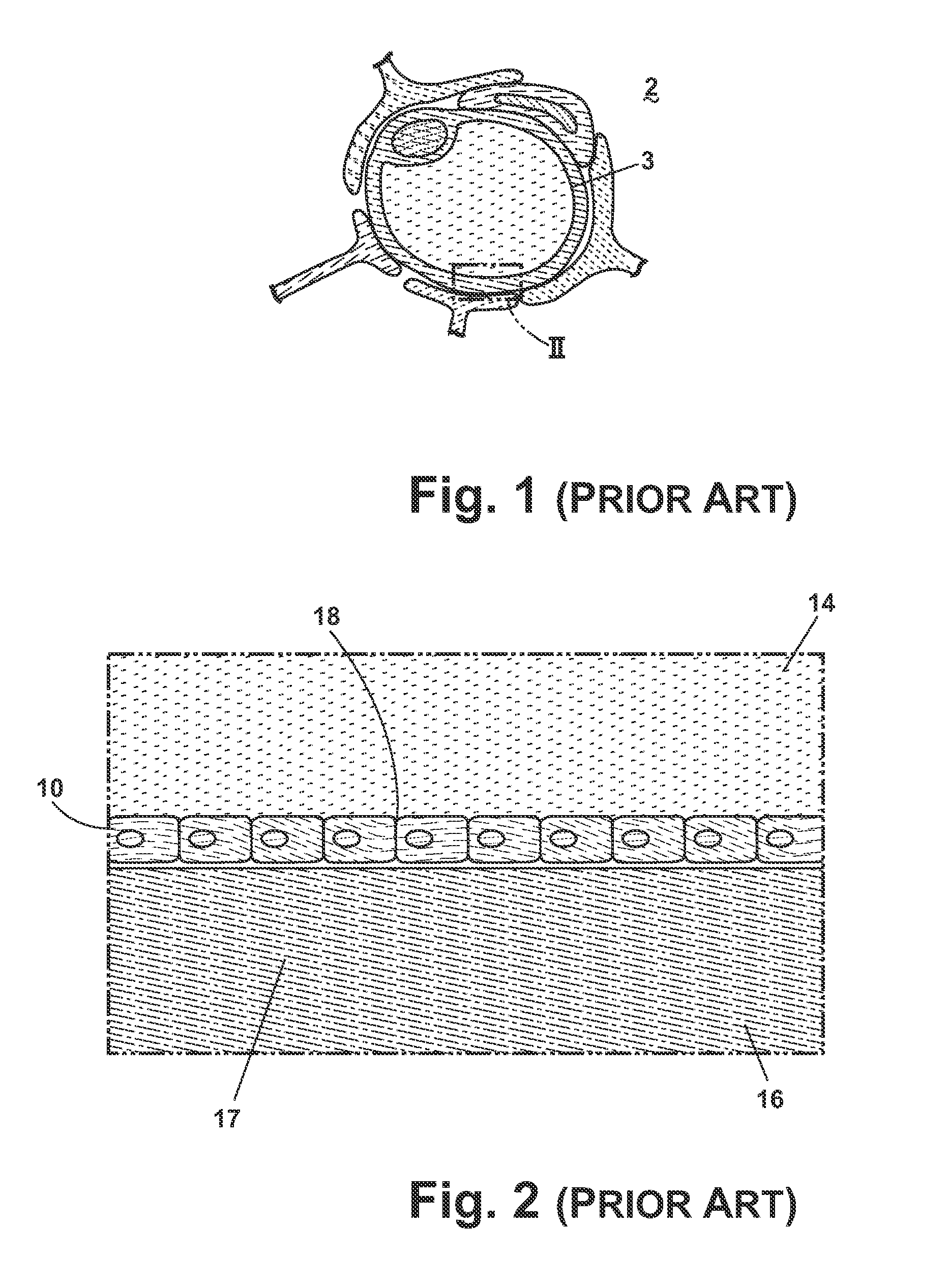Composition and methods of treatment of bacterial meningitis