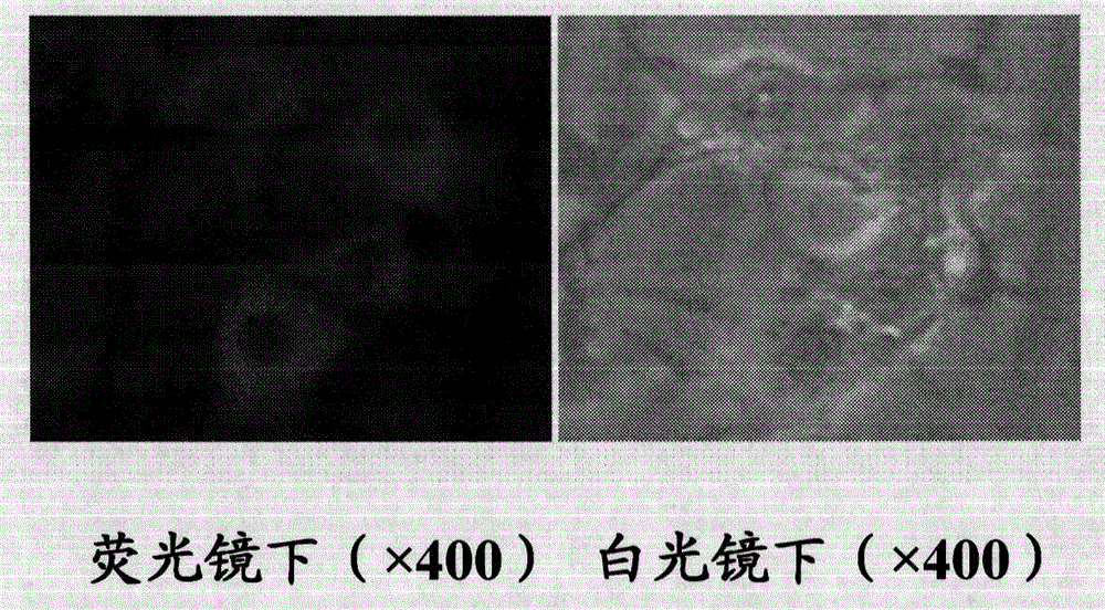 Monoclonal antibody against human alpha1 acid glycoprotein and preparation method thereof