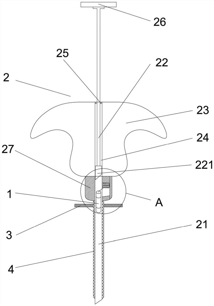 Removable double gold marker implantation device with little damage and implantation method thereof