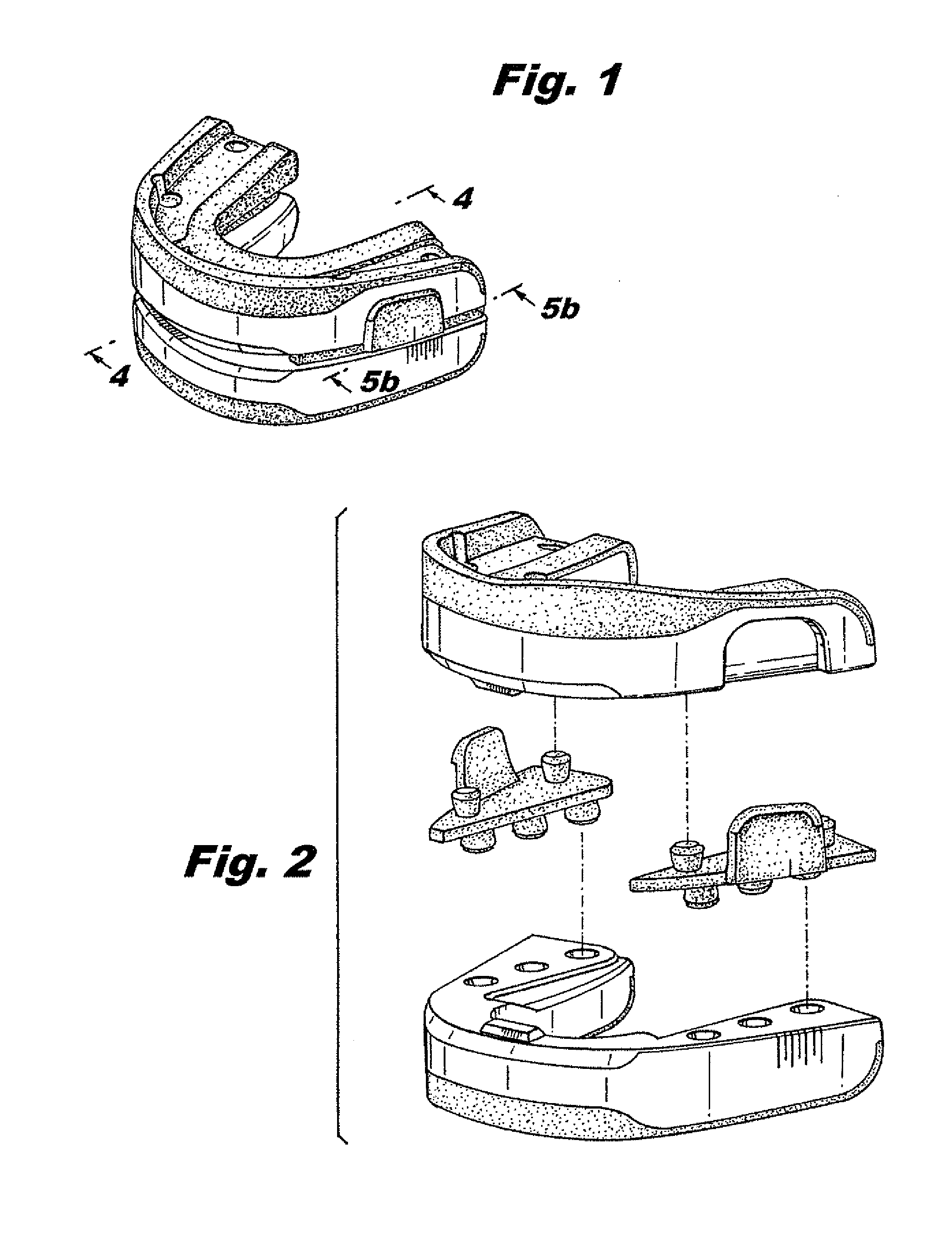 Apparatus and kit for an oral appliance and method for using same