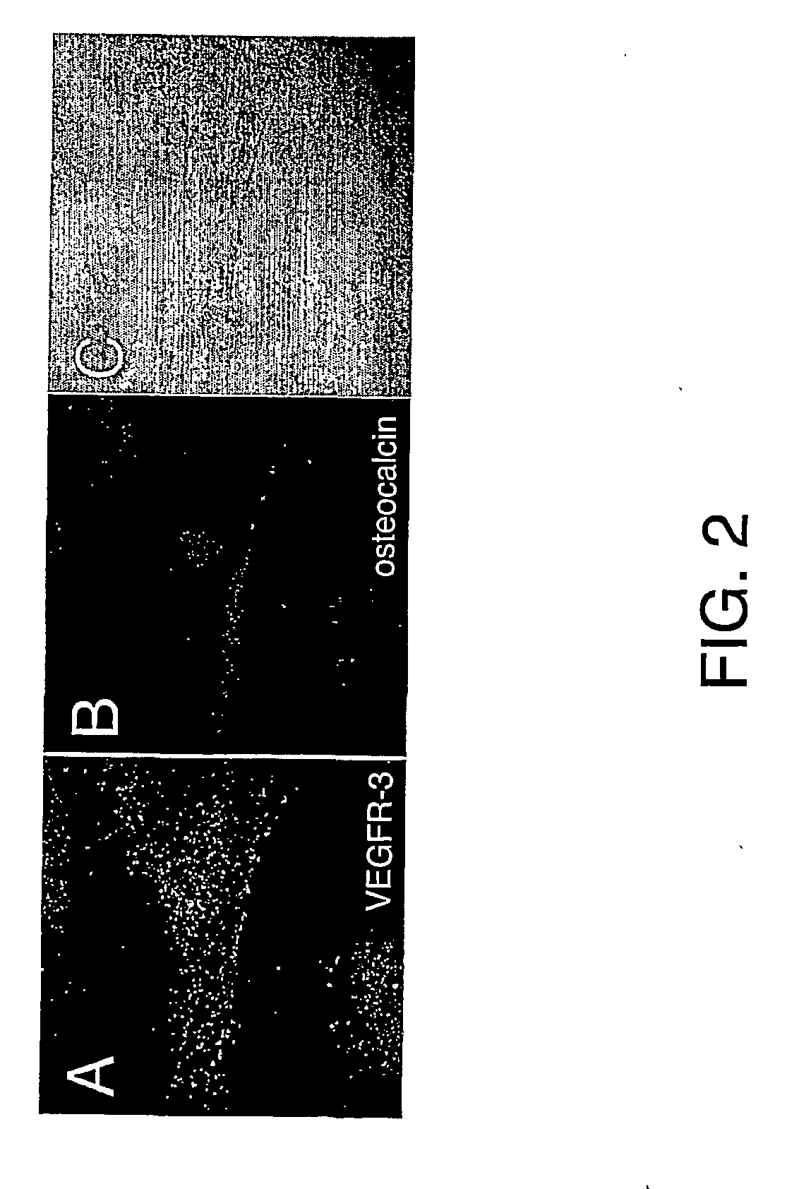 Vascular endothelial growth factor-d (VEGF)-d and functionally fragments thereof for bone repairing