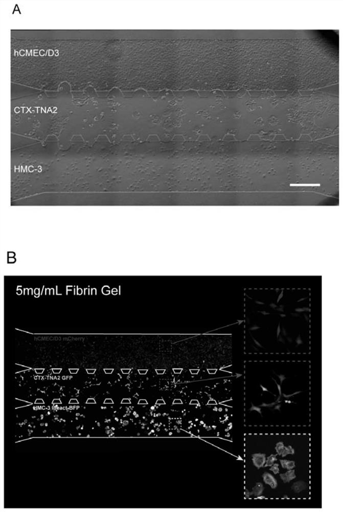 Bionic micro-fluidic chip for simulating pathological blood-brain barrier based on fibrous protein gel and construction method of bionic micro-fluidic chip