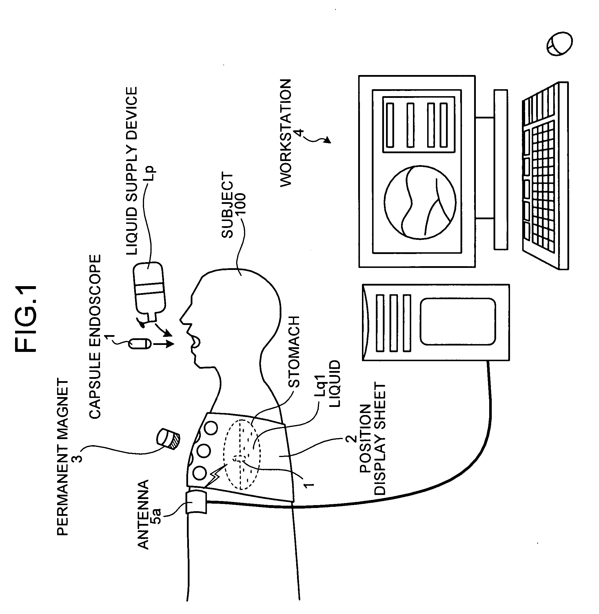 Body-insertable device system and body-insertable device guiding method