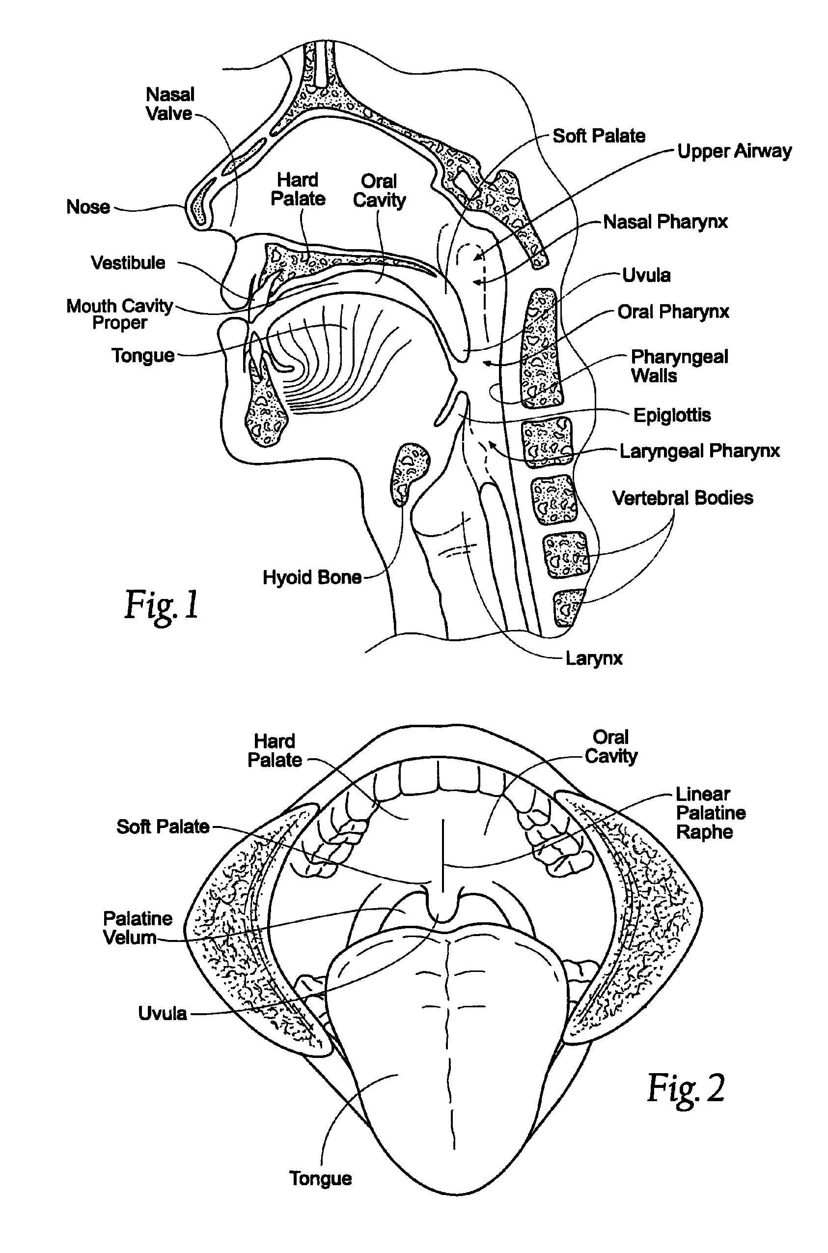 Magnetic devices, systems, and methods placed in or on a tongue