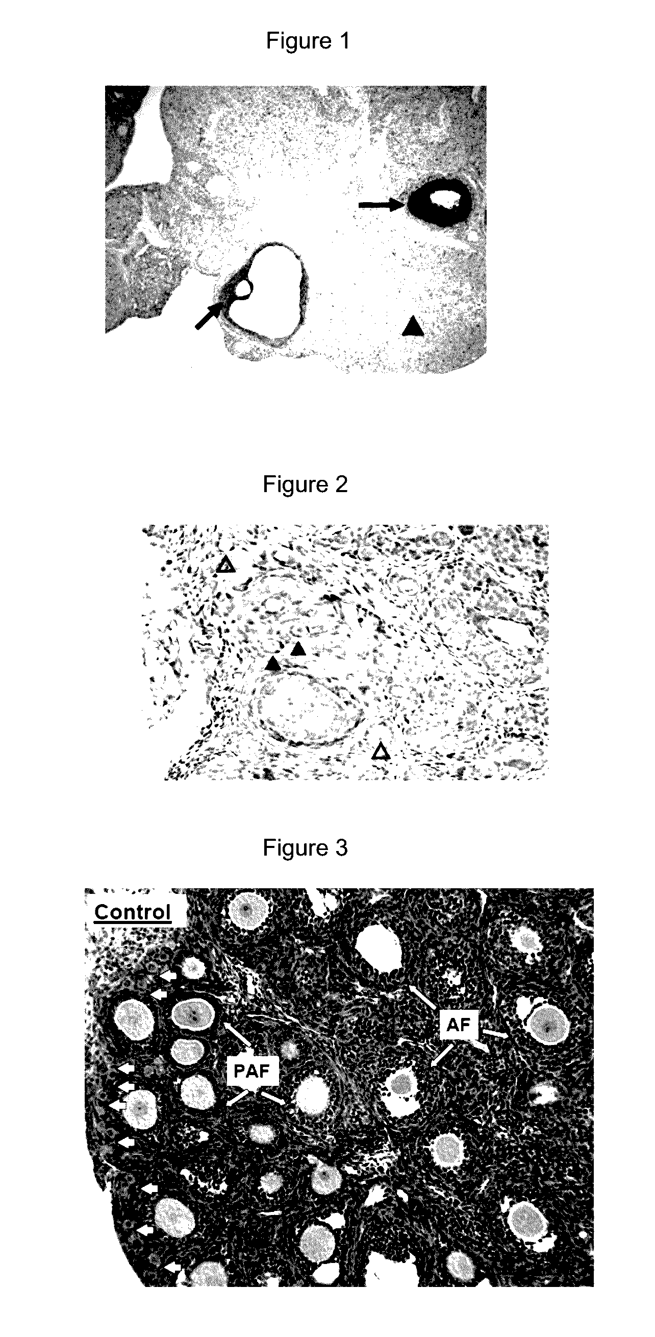 Manipulation of ovarian primordial follicles