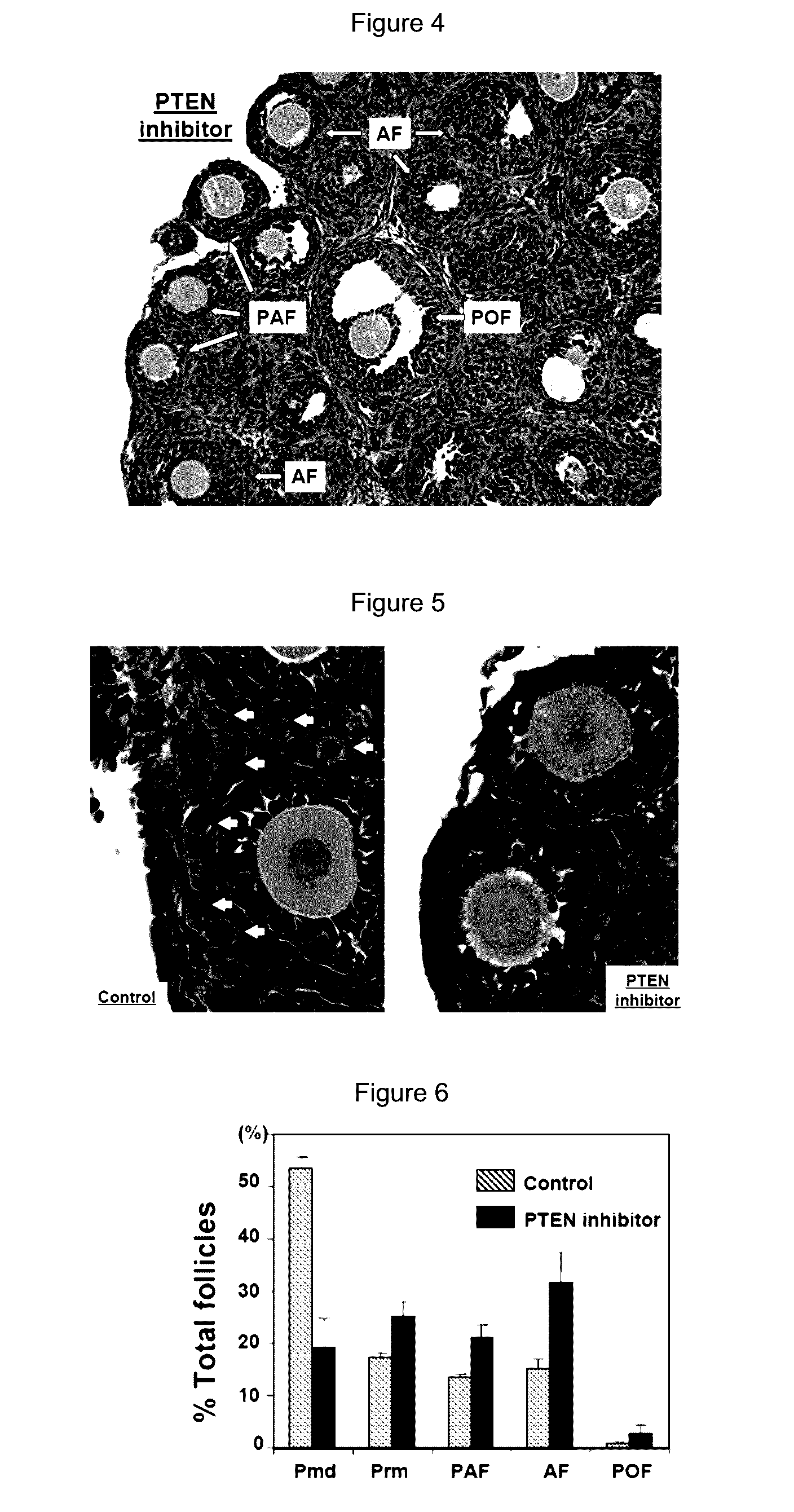 Manipulation of ovarian primordial follicles