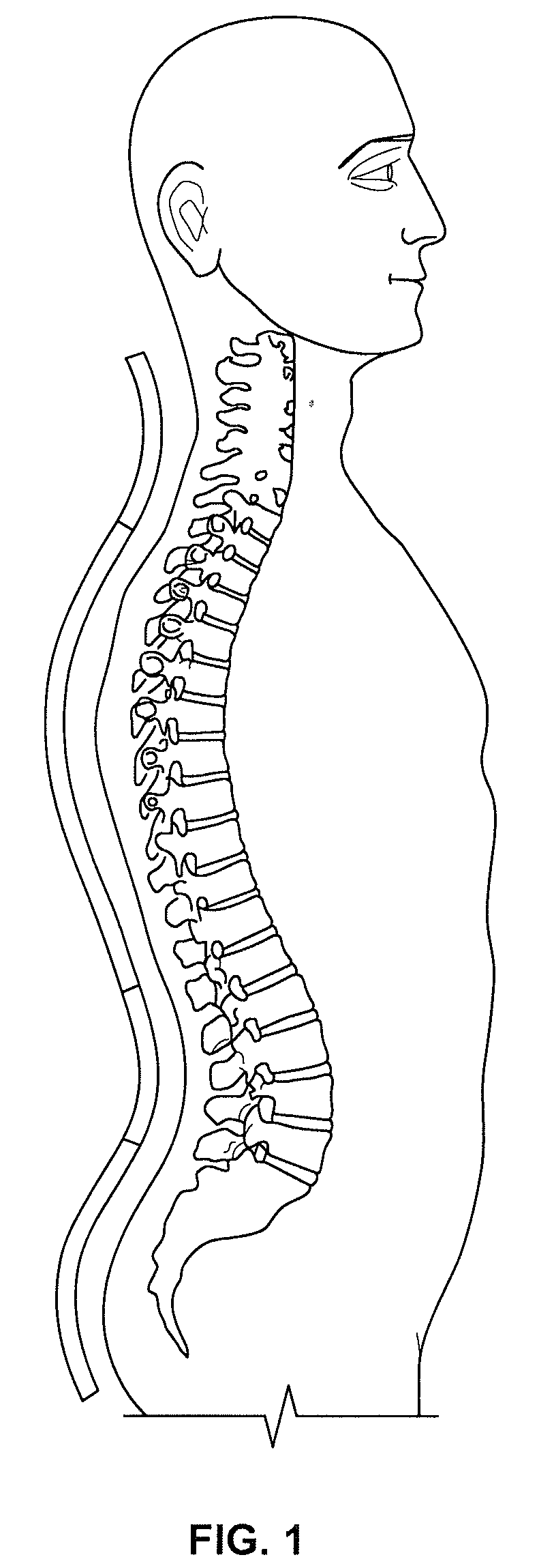 Devices and methods for intervertebral therapy