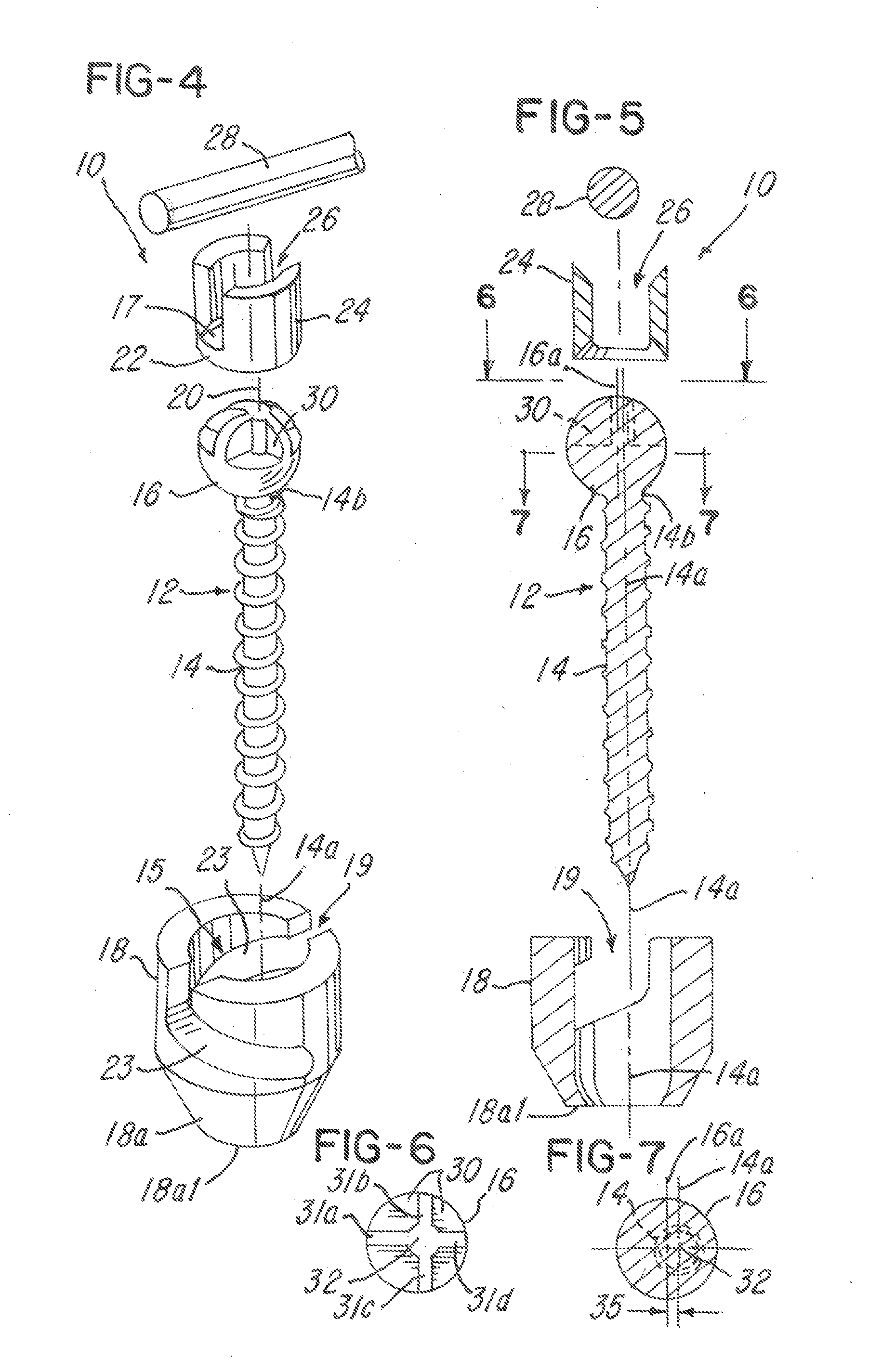 Offset multiaxial or polyaxial screw, system and assembly