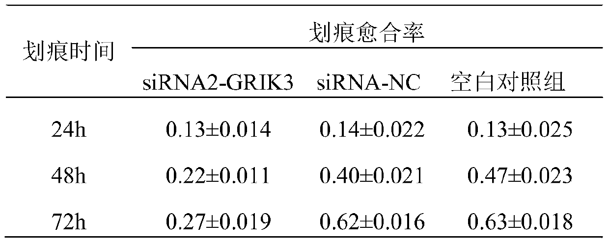 Molecular marker GRIK3 in rectal adenocarcinoma