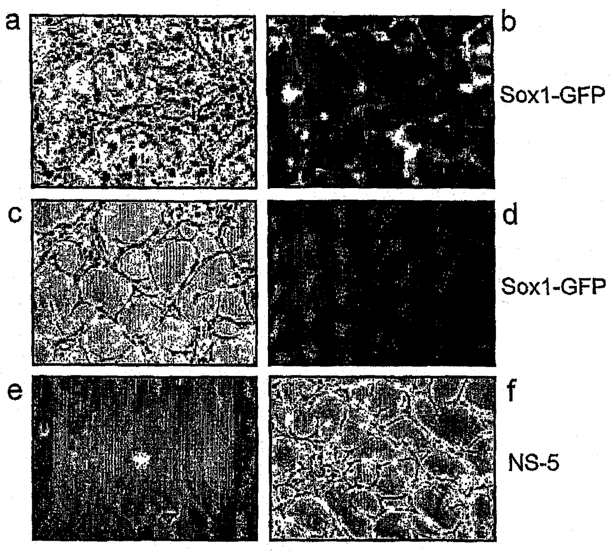 neural stem cells