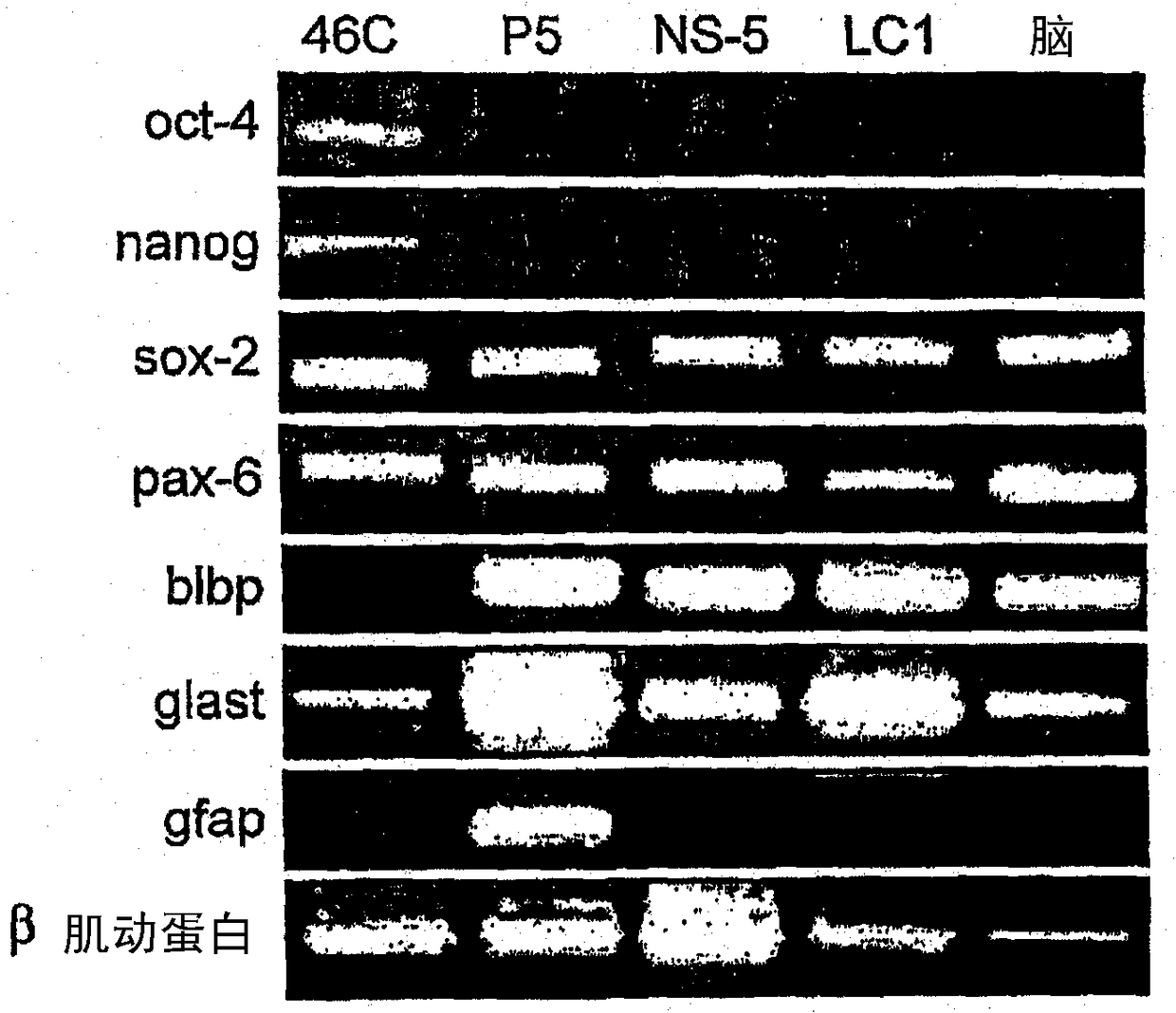 neural stem cells