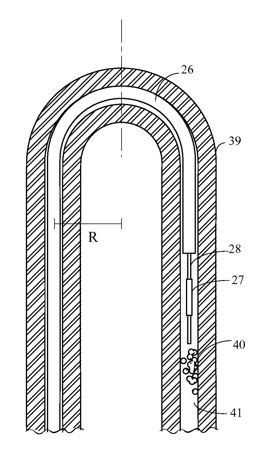 Devices for clearing blockages in in-situ artificial lumens
