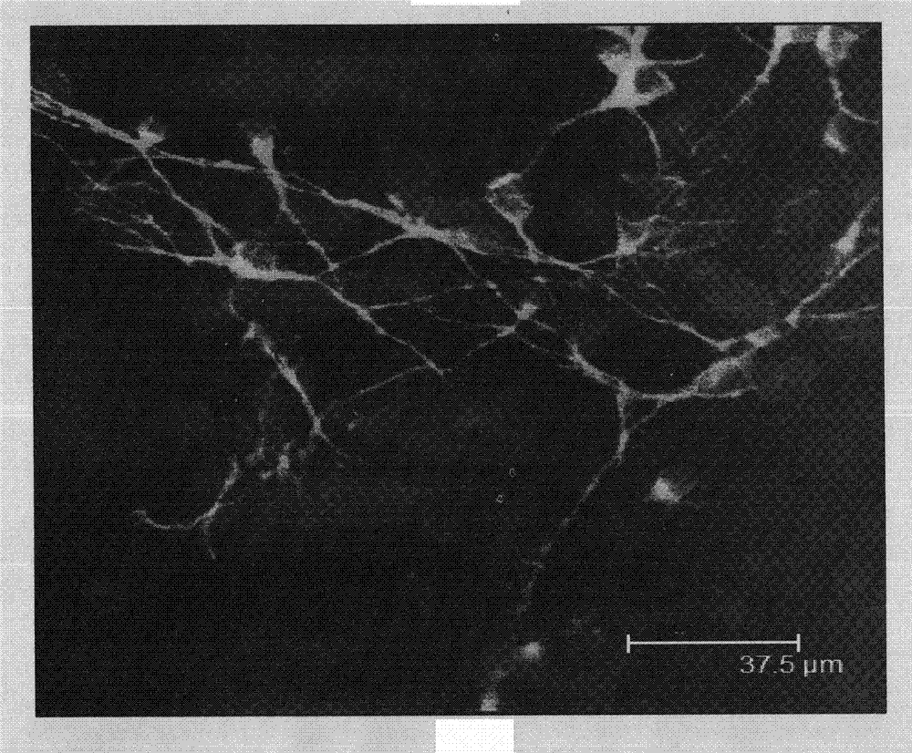 Method for preparing tissue engineering spinal cord by using ancestral cells originated from skin