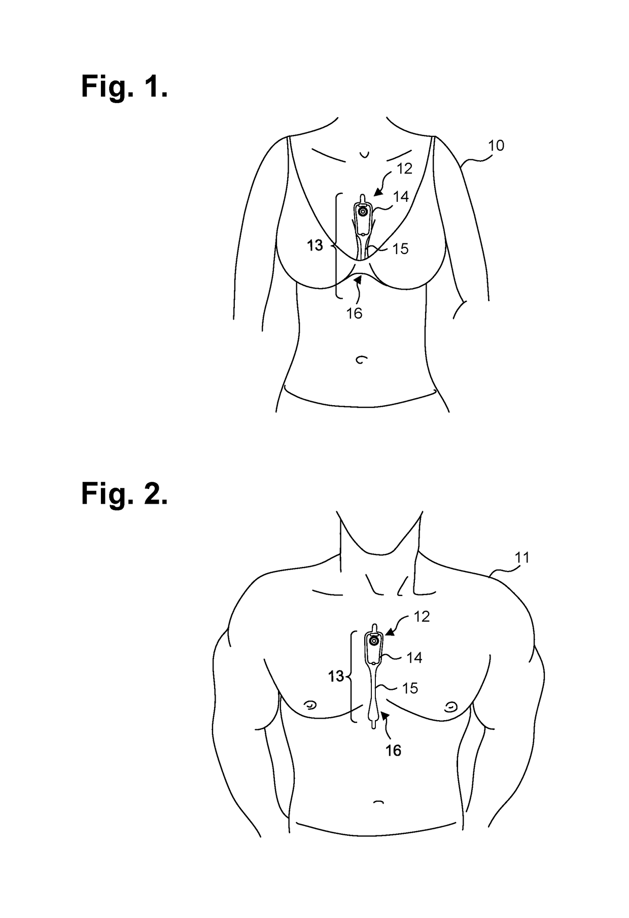 Computer-implemented system and method for providing a personal mobile device-triggered medical intervention