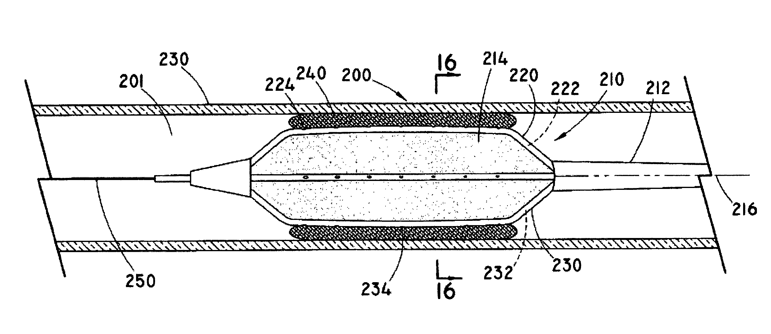 Therapeutic agent delivery system