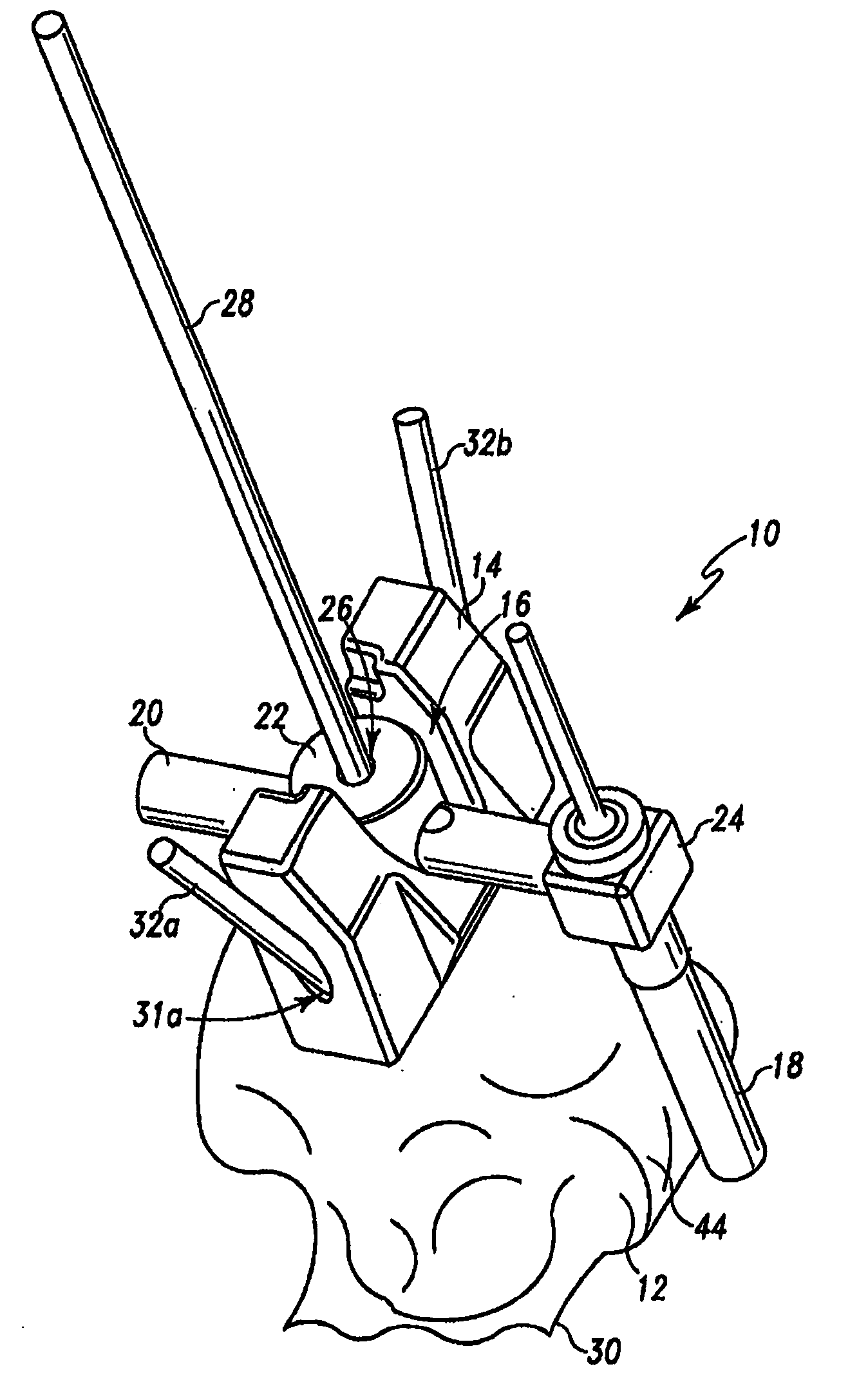 Humeral rotating burr guide