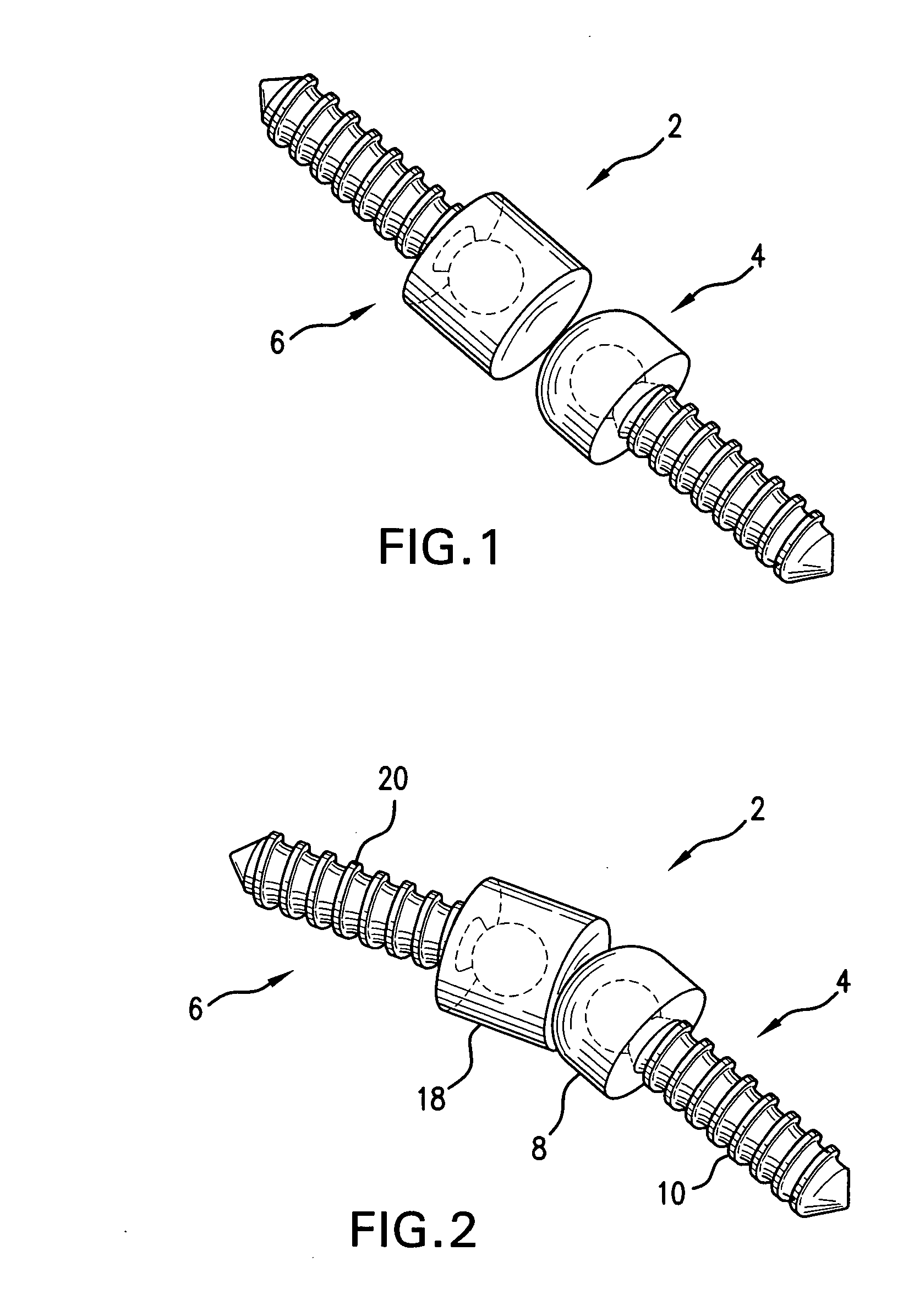 Modular joint replacement implant with hydrogel surface