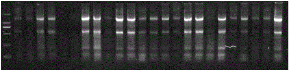 LAMP (loop-mediated isothermal amplification) primer group CK7-18 for rapid detection of lymphatic metastasis of head and neck squamous cell carcinoma (HNSCC)