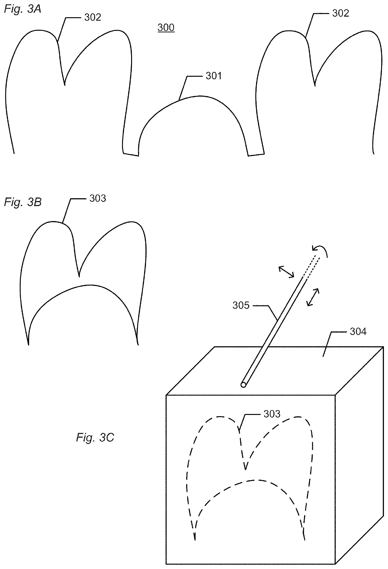 Automated production of dental restoration