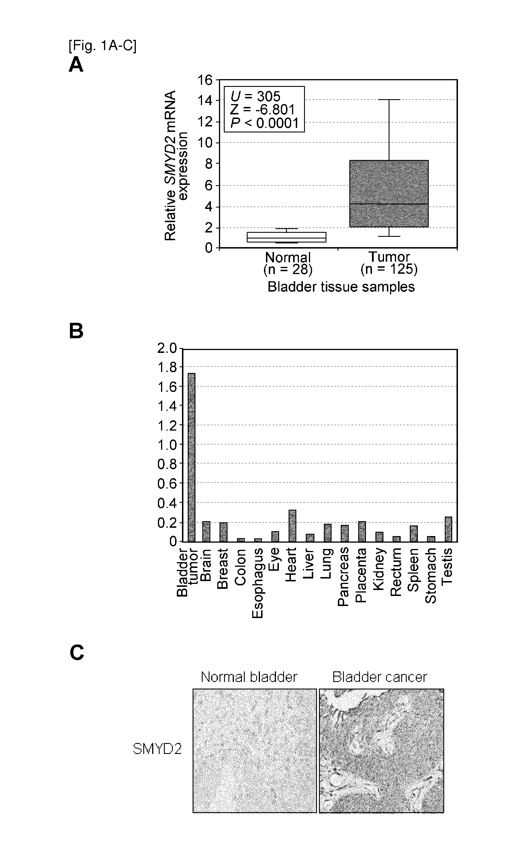 Smyd2 as a target gene for cancer therapy and diagnosis