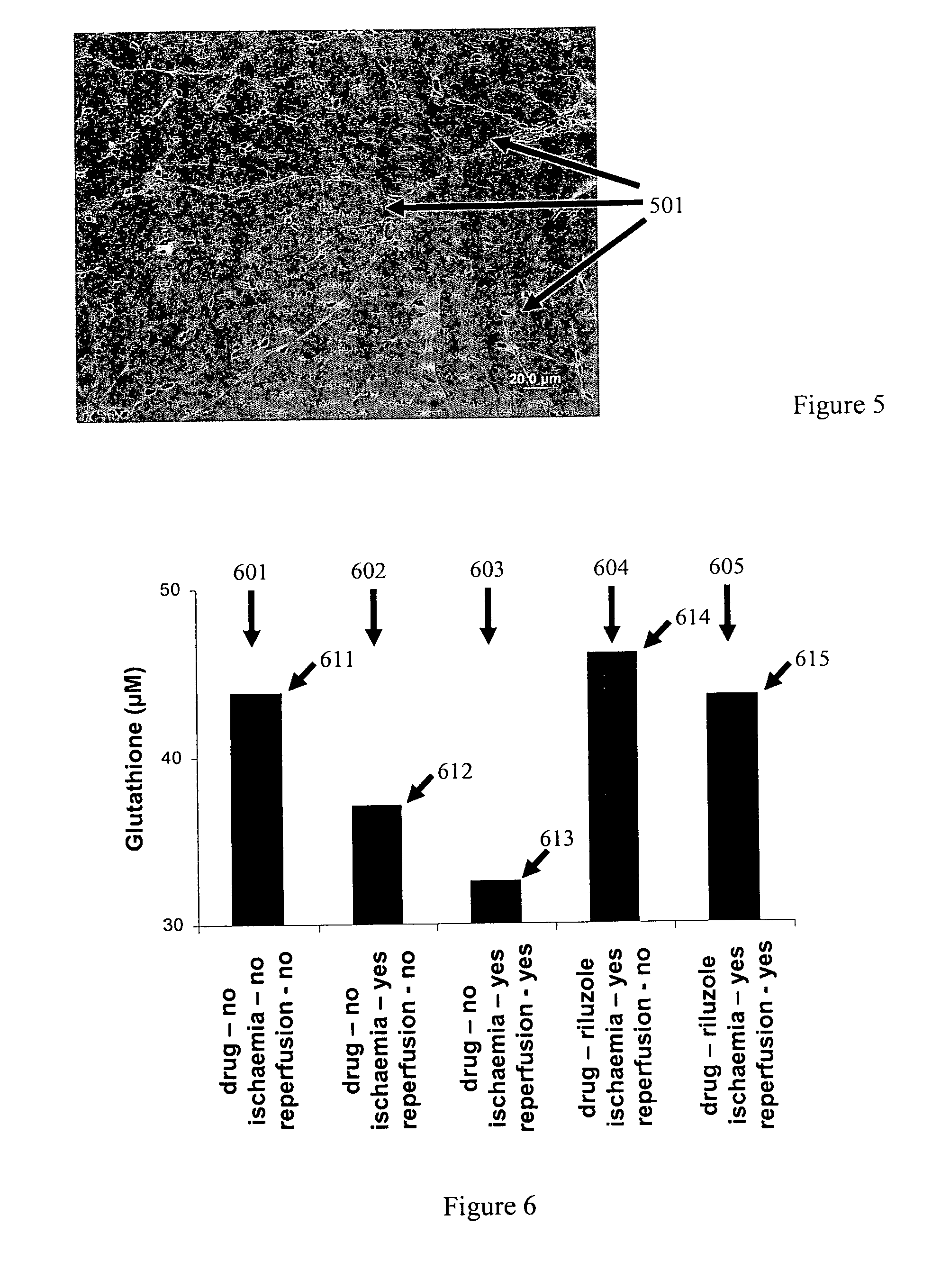 Treatment of non-neuronal and non-myocardial cell, tissue and organ damage and associated pain with persistent sodium current blockers