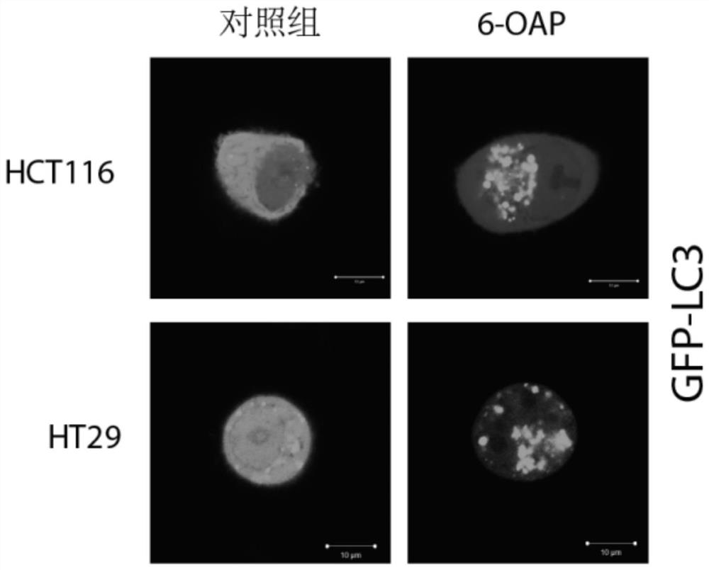 Application of erodium stephanianum willd element as autophagy-lysosome signal channel blocker