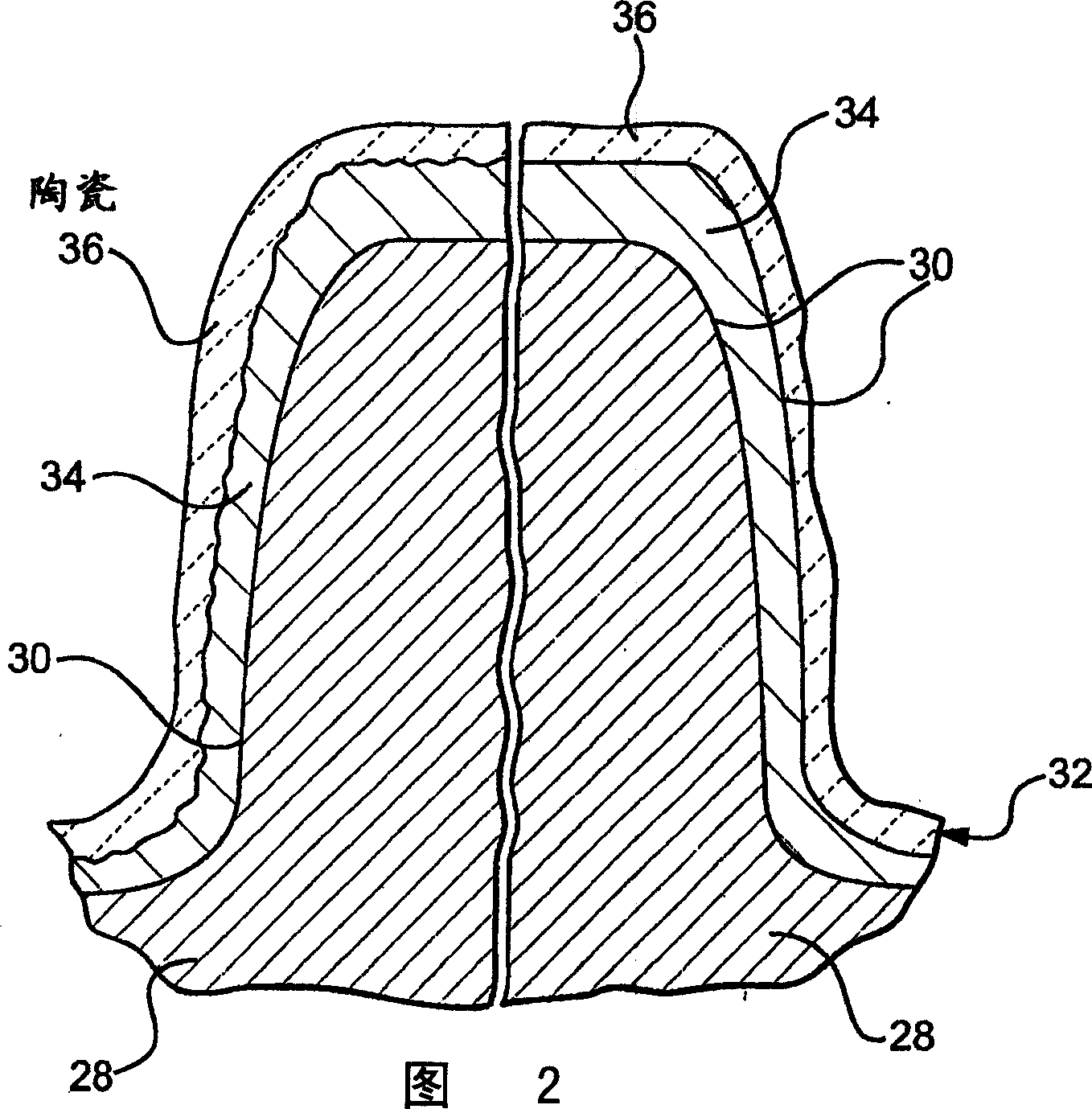 Planetary gearset with multi-layer coated sun gear