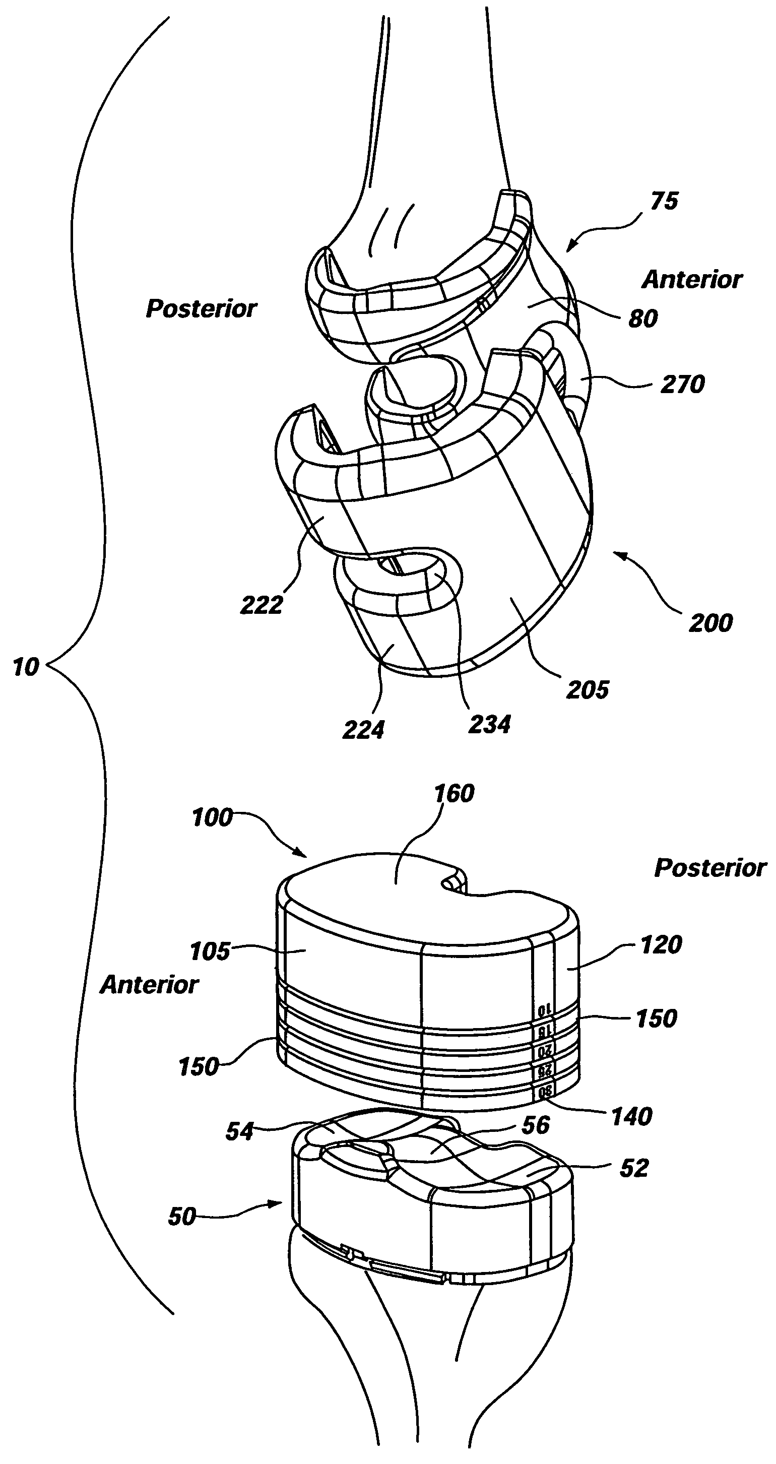 Method of forming a temporary prosthetic joint using a disposable mold