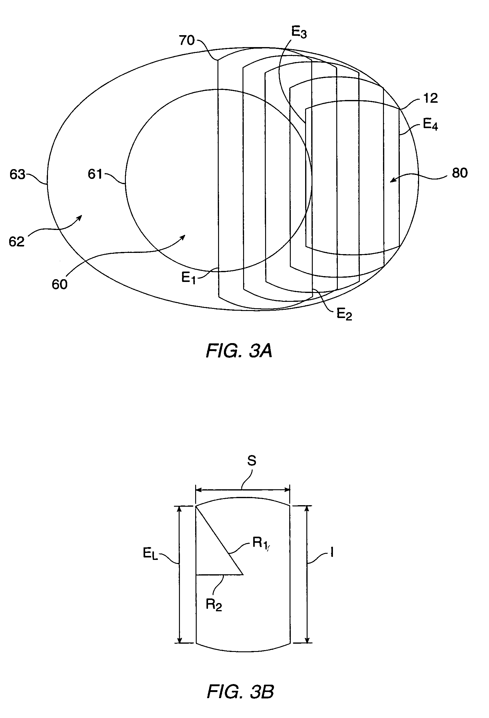 Systems and methods for corneal surface ablation to correct hyperopia