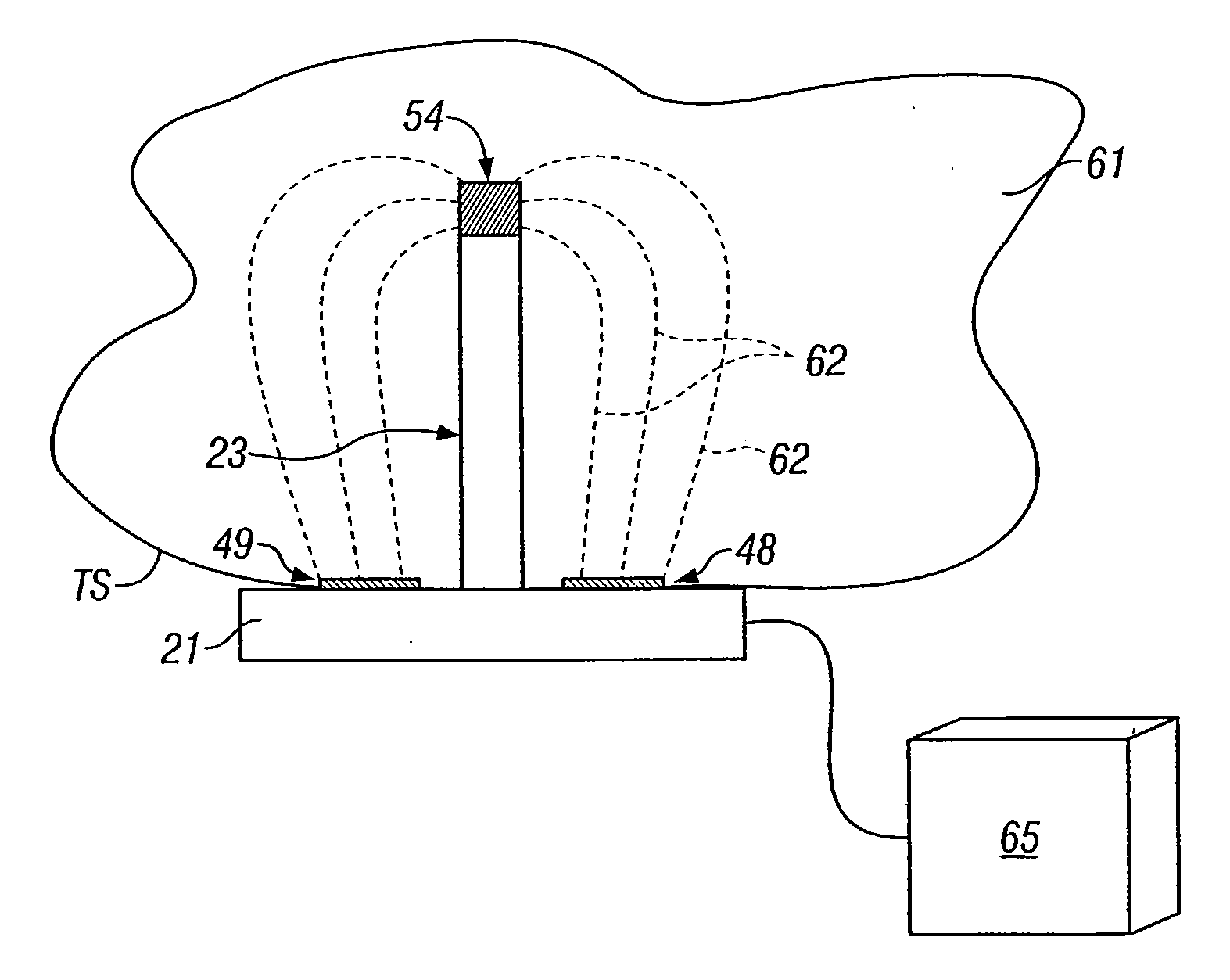 Electroporation Microneedle and Methods For Its Use