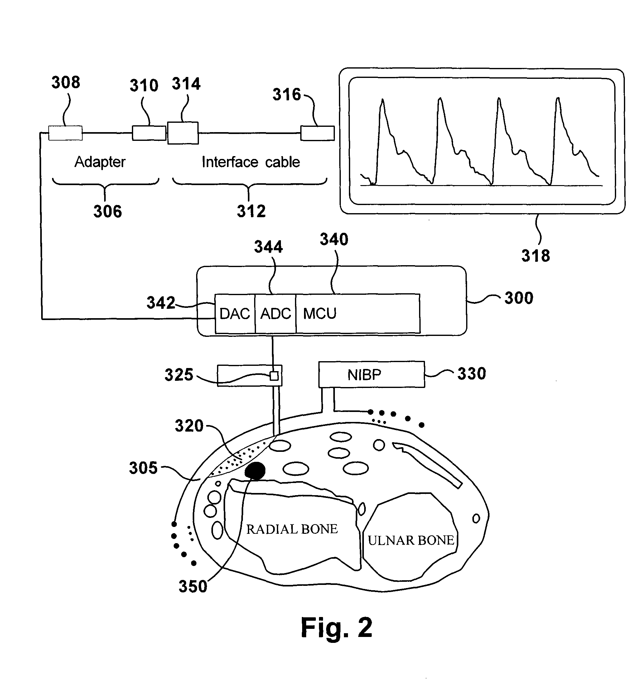 Apparatus and method for continuous oscillometric blood pressure measurement