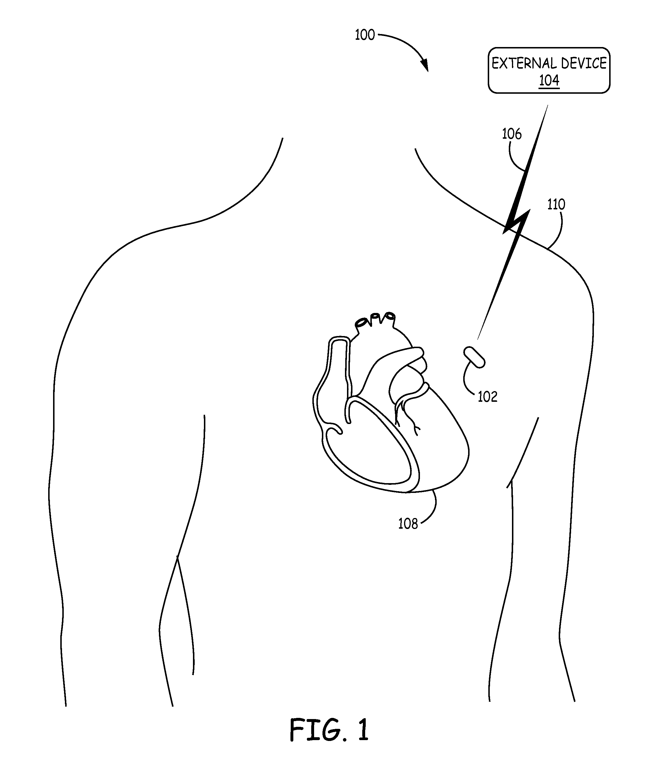 Implantable medical devices having cofire ceramic modules and methods of fabricating the same