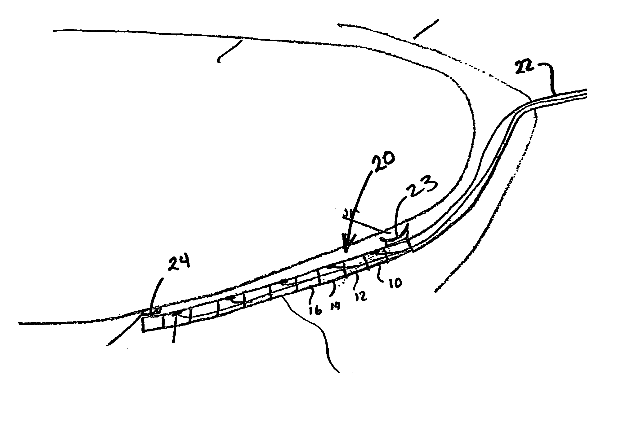 Perficardial pacing lead placement device and method