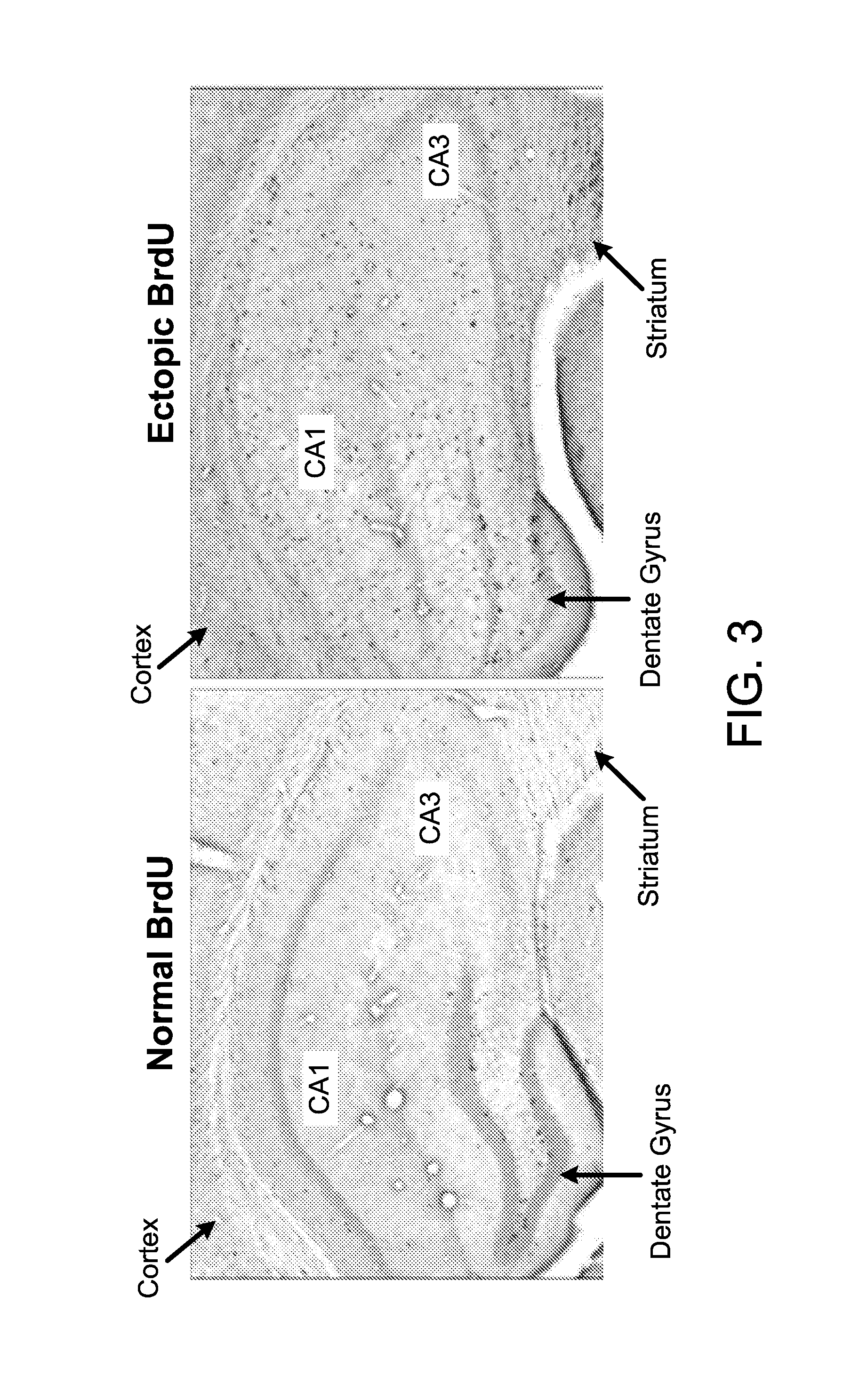 Methods for treating Parkinson's disease using pro-neurogenic compounds