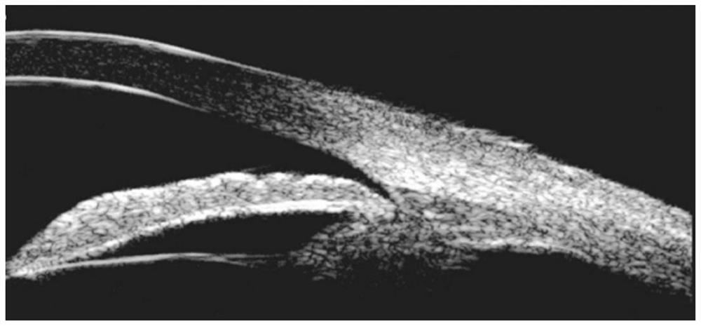 An anterior segment three-dimensional ultrasound scanning imaging device and method