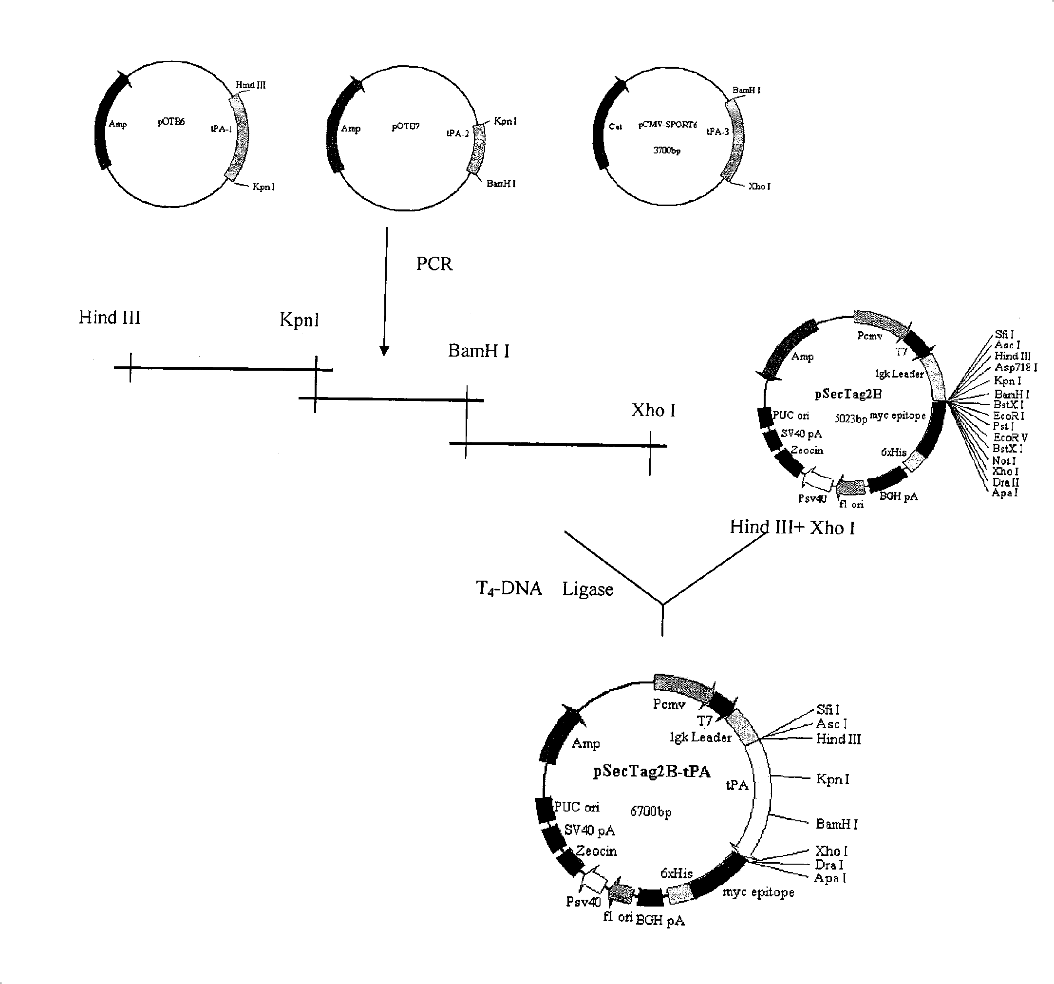 Recomposed tPA gene-chitosan nanoparticle complex and preparation method thereof